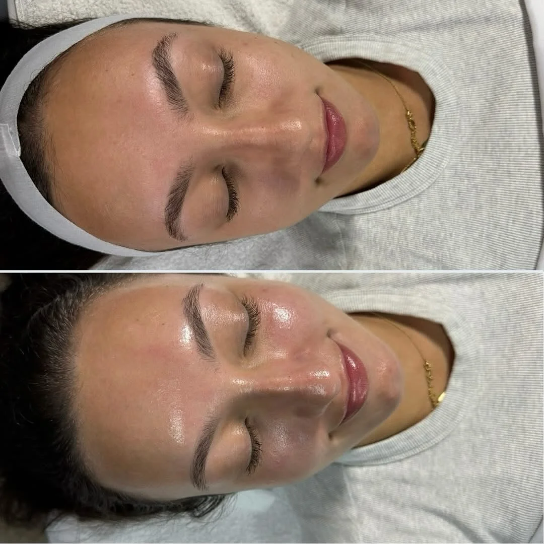 Cozy season skin 🪩🎃

The pumpkin peel is a 5% lactic acid peel with pumpkin and papain enzymes. With zero downtime this treatment is going to gently slough off the post summer dead skin cells that we&rsquo;re hanging onto and brighten the complexio