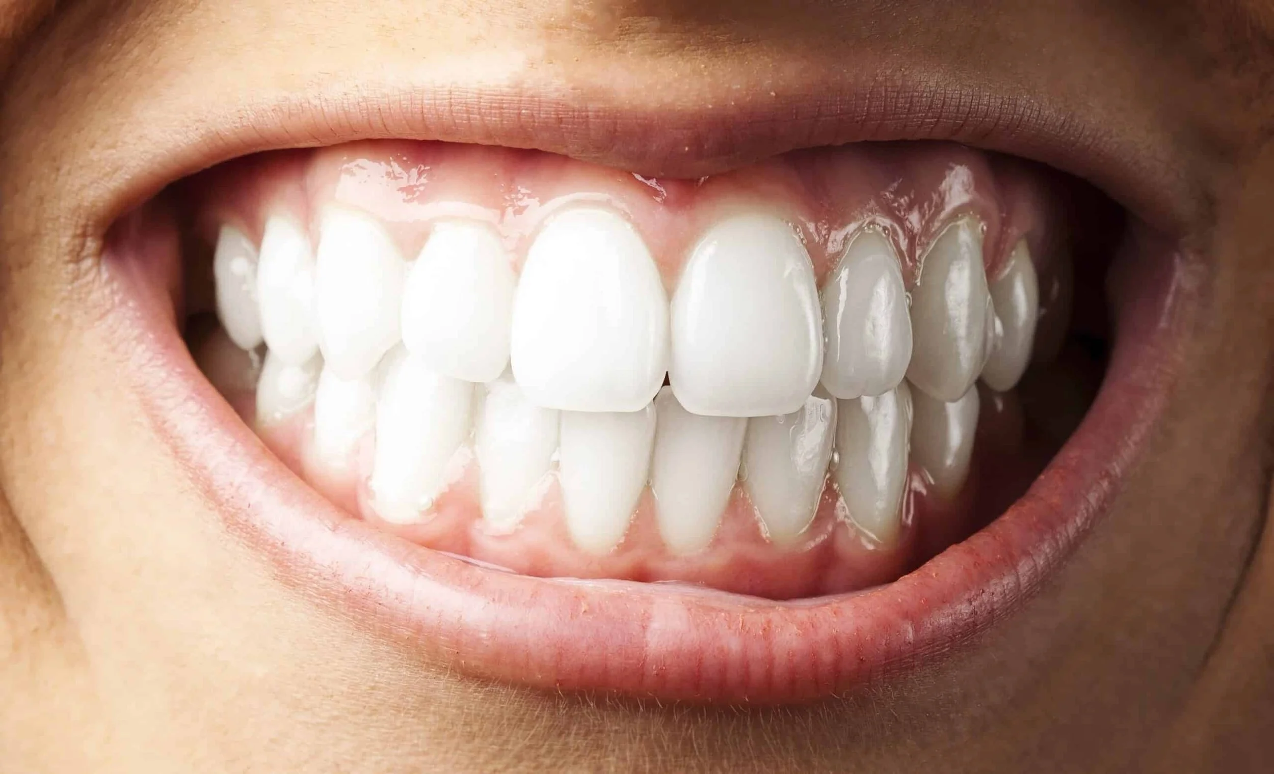 Close-up-of-young-person-showing-teeth-and-bite-scaled.jpg