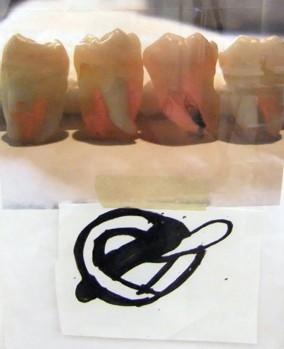  Amy Feldman,  Pretzel teeth  2011 Collage, marker and tape on paper, 8.5 x 11 in 