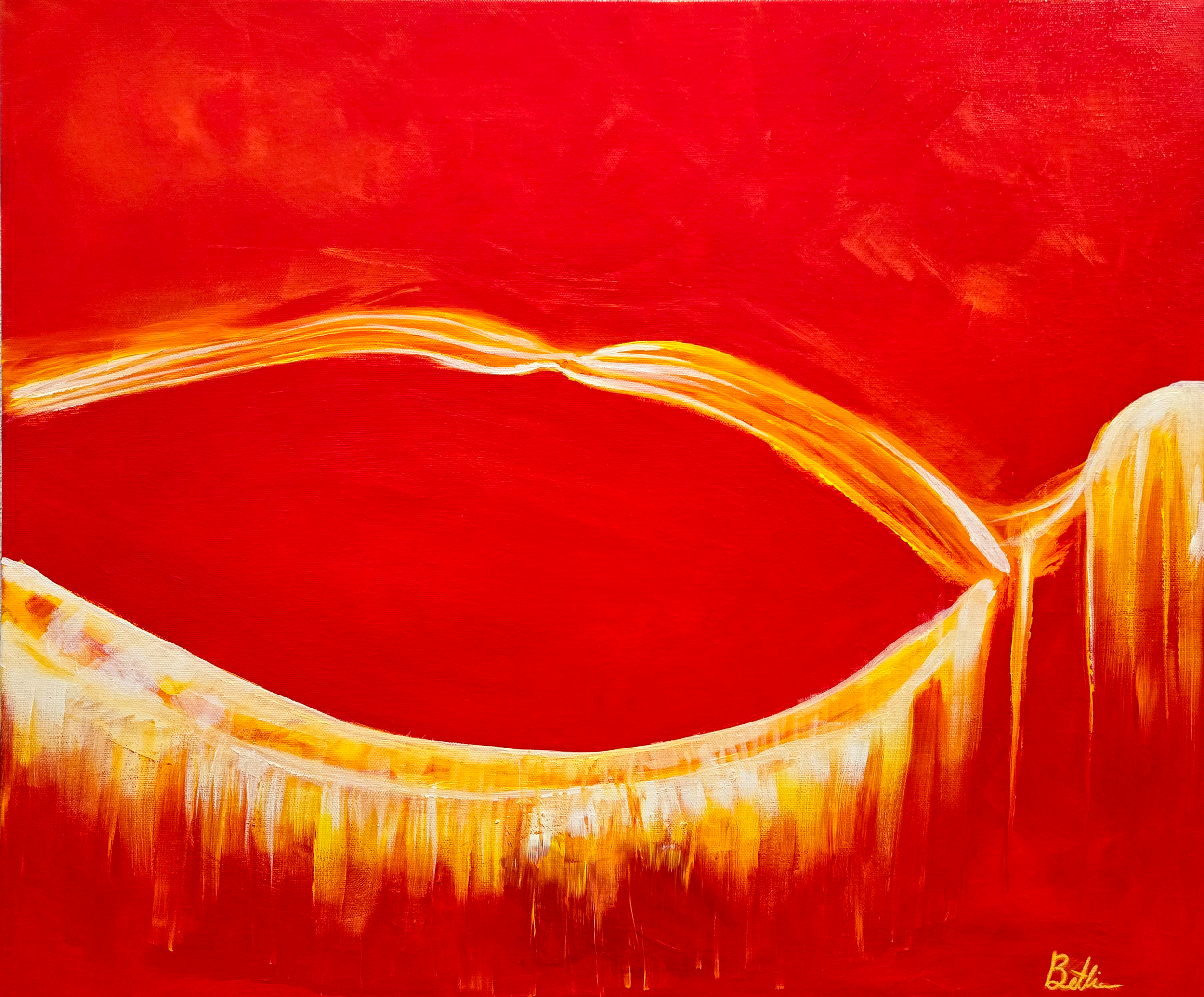 Retinal Detachment 1
