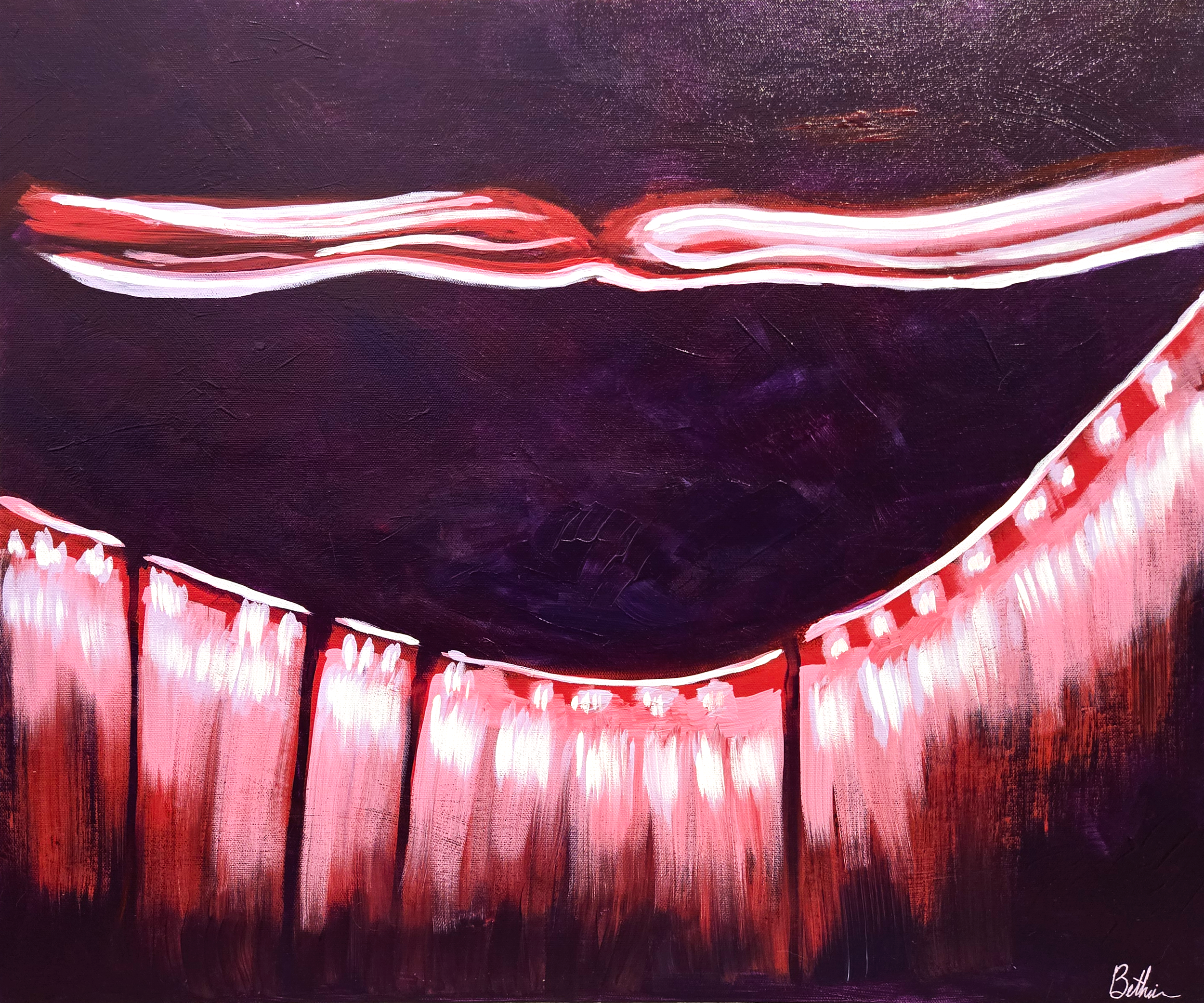 Retinal Detachment 2