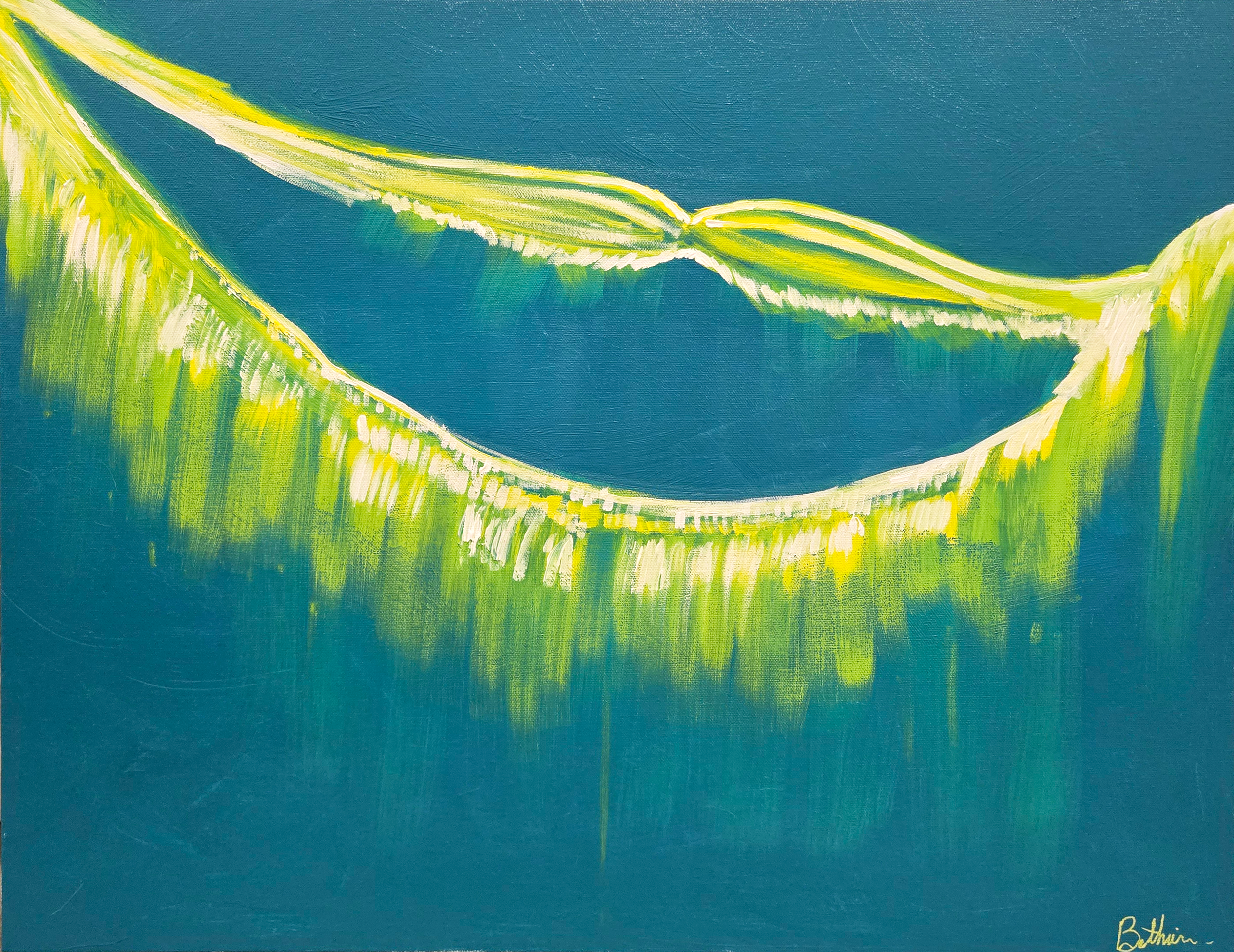 Retinal Detachment 3