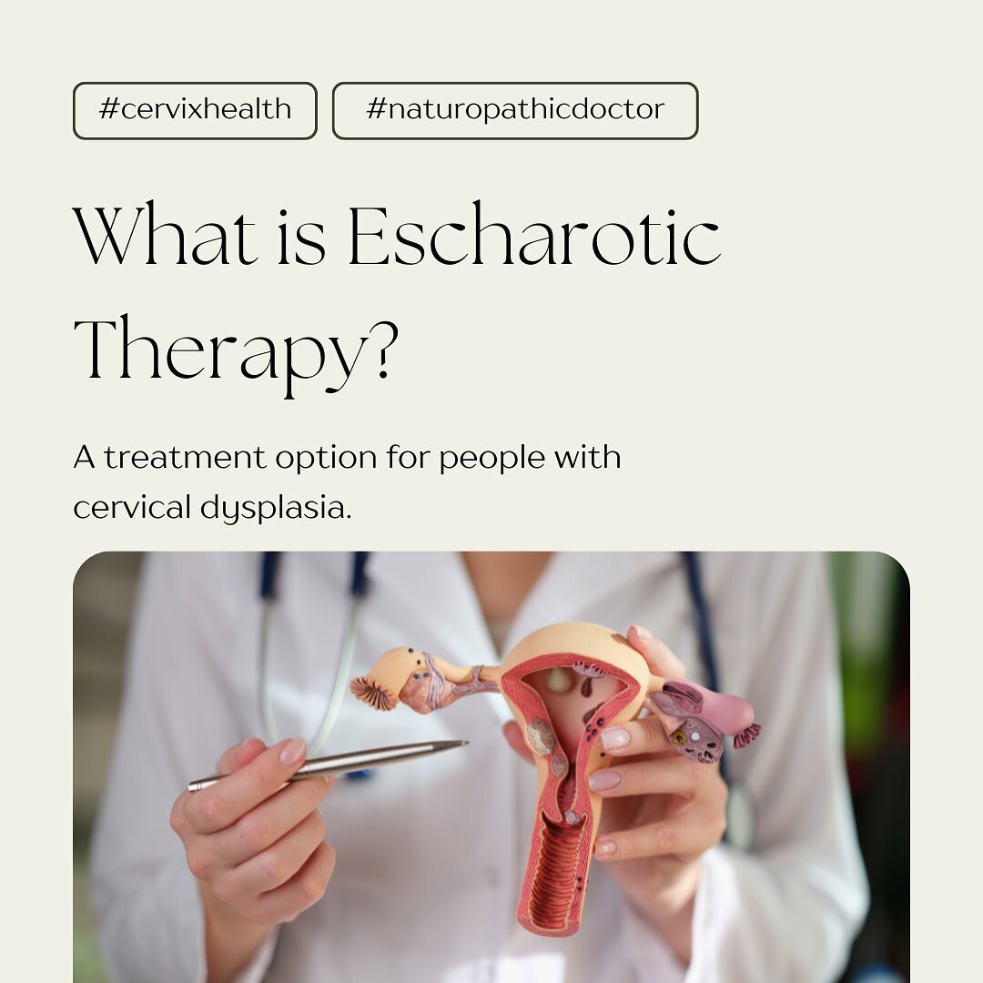 What is Escharotic Therapy?

Escharotic Therapy is a topical application of an herbal/mineral solution directly onto the cervix that targets abnormal cells while sparing healthy cells.

Escharotic therapy is a treatment option for cervical dysplasia,