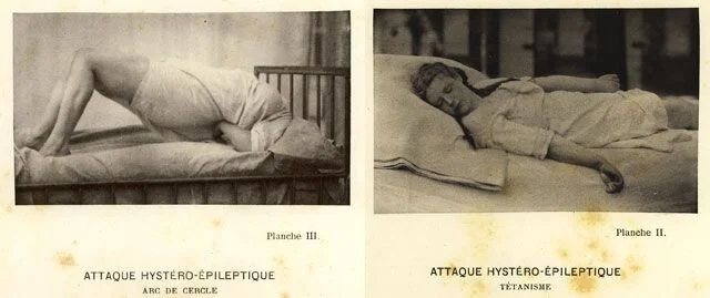 Hysteripatient, sent 1800-tal.