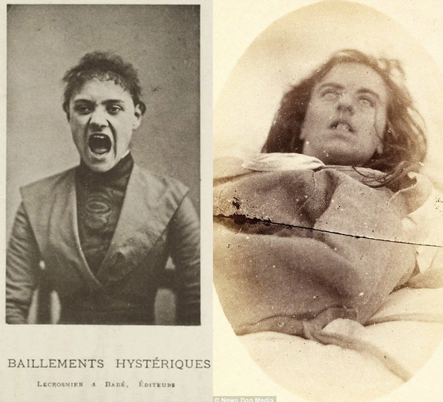 Hysteripatienter, 1870-tal.