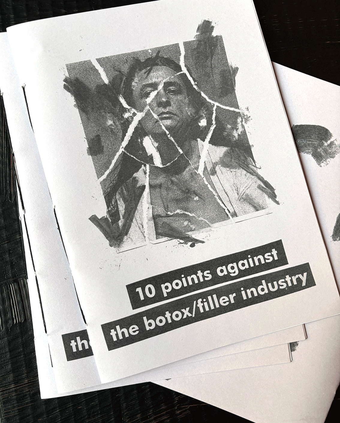 10 points against the Botox/filler industry