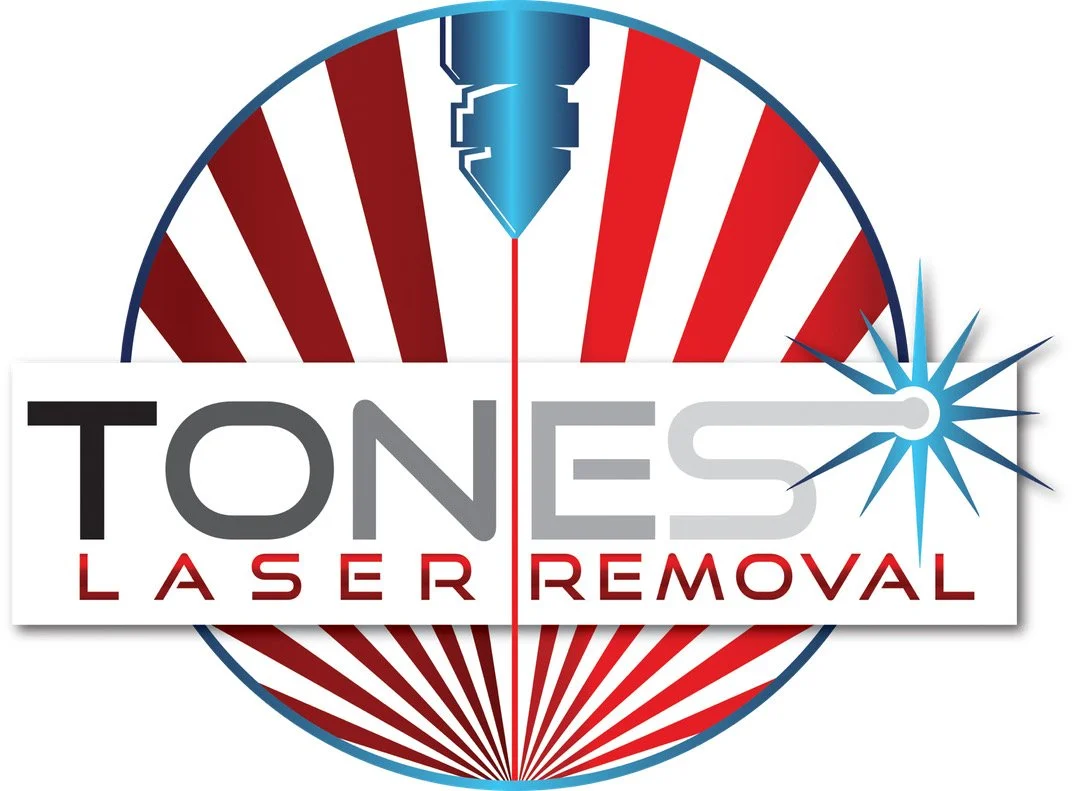 Tones laser removals logo