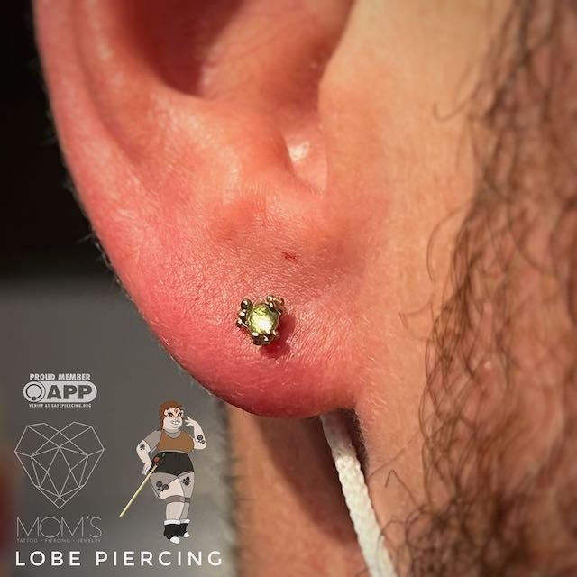 First lobe (1 of 2)