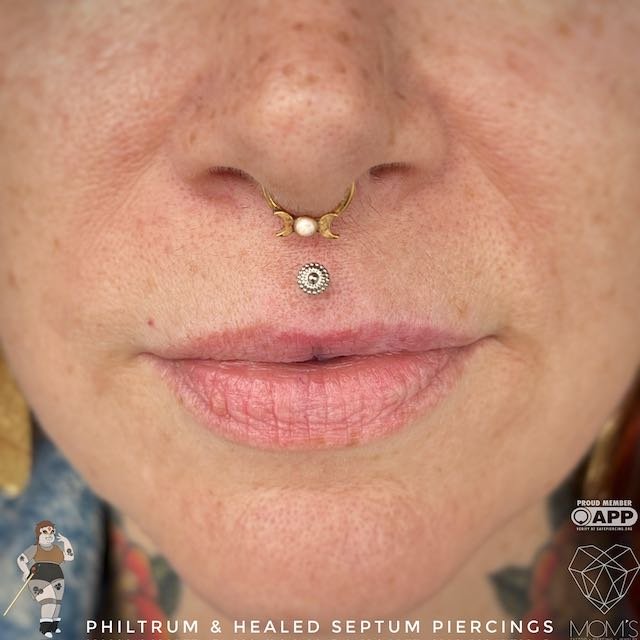 Fresh Philtrum (Medusa) Piercing and Healed Septum Piercing