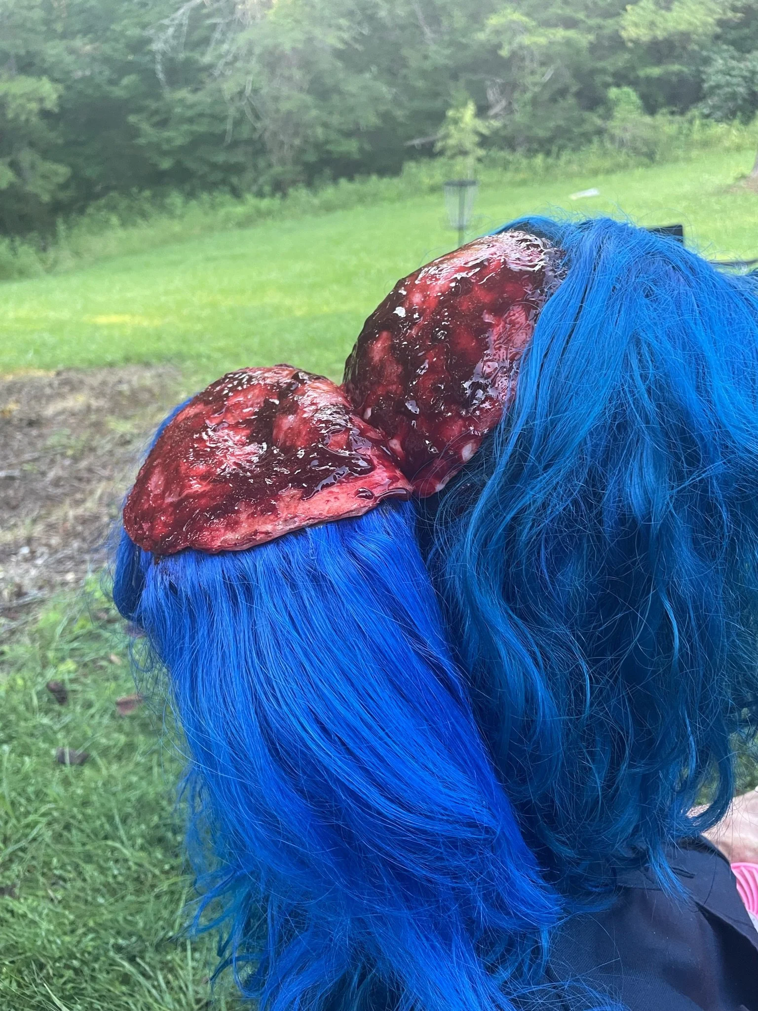 Scalped head from side: LESIONS Movie