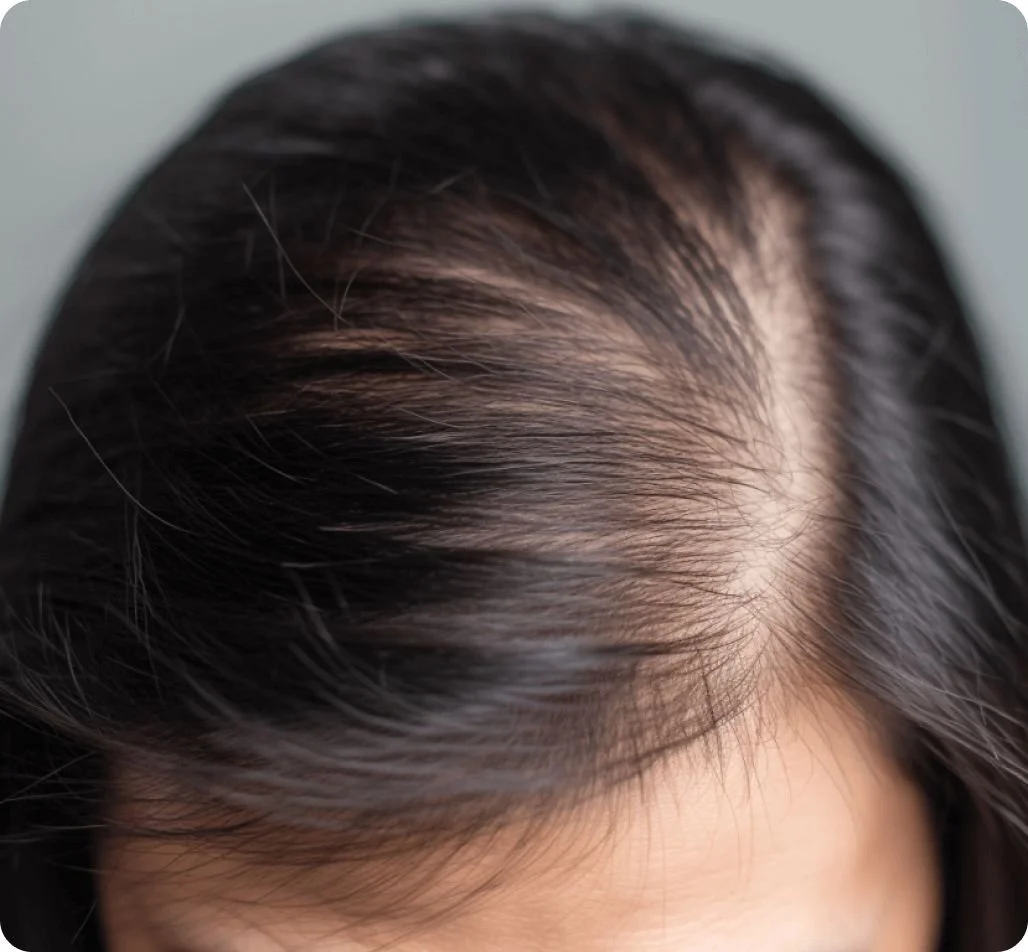How to Slow Down Hair Thinning: Salon Treatments That Actually Work