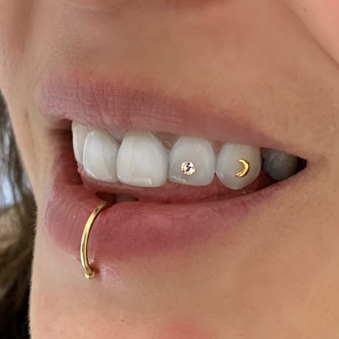Tooth 👏🏻 jewelry 👏🏻 is 👏🏻 back! Swarovski crystals are $50 or 2 for $80. Gold charms are $120. Book an appointment online or come in to see our tooth jewelry selection ✨ all colors and sizes of genuine Swarovski crystals 💎 selection of gold ch