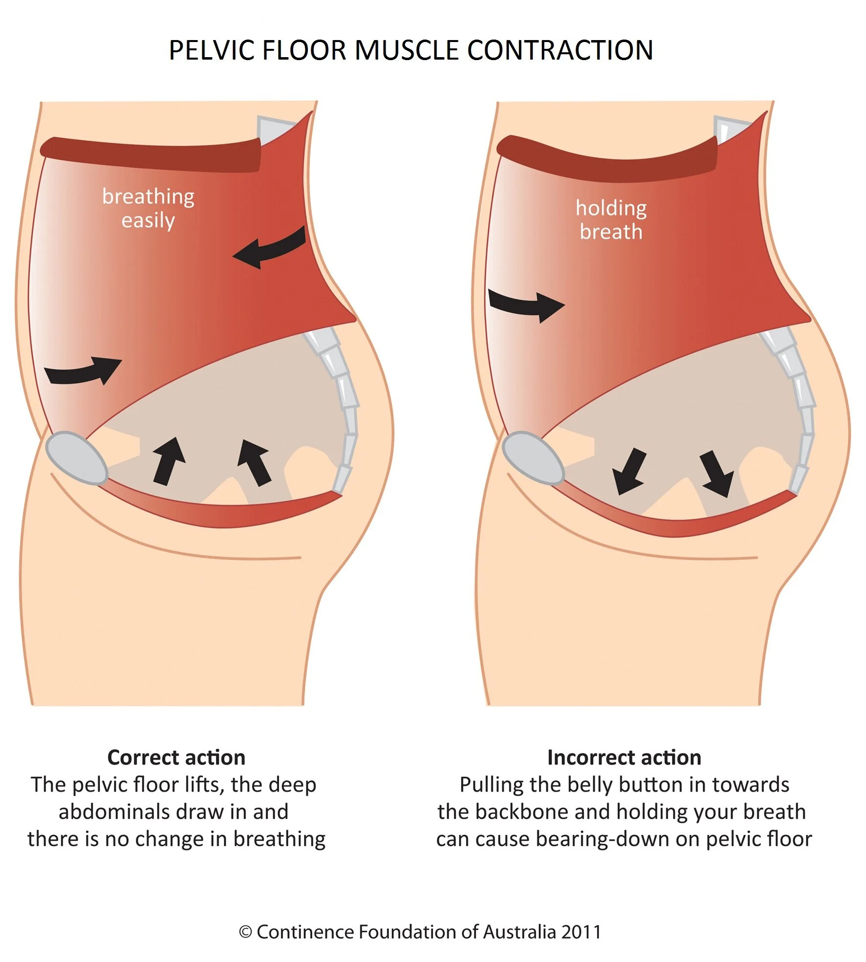 Kegels? Here's how to contract your Pelvic Floor correctly!