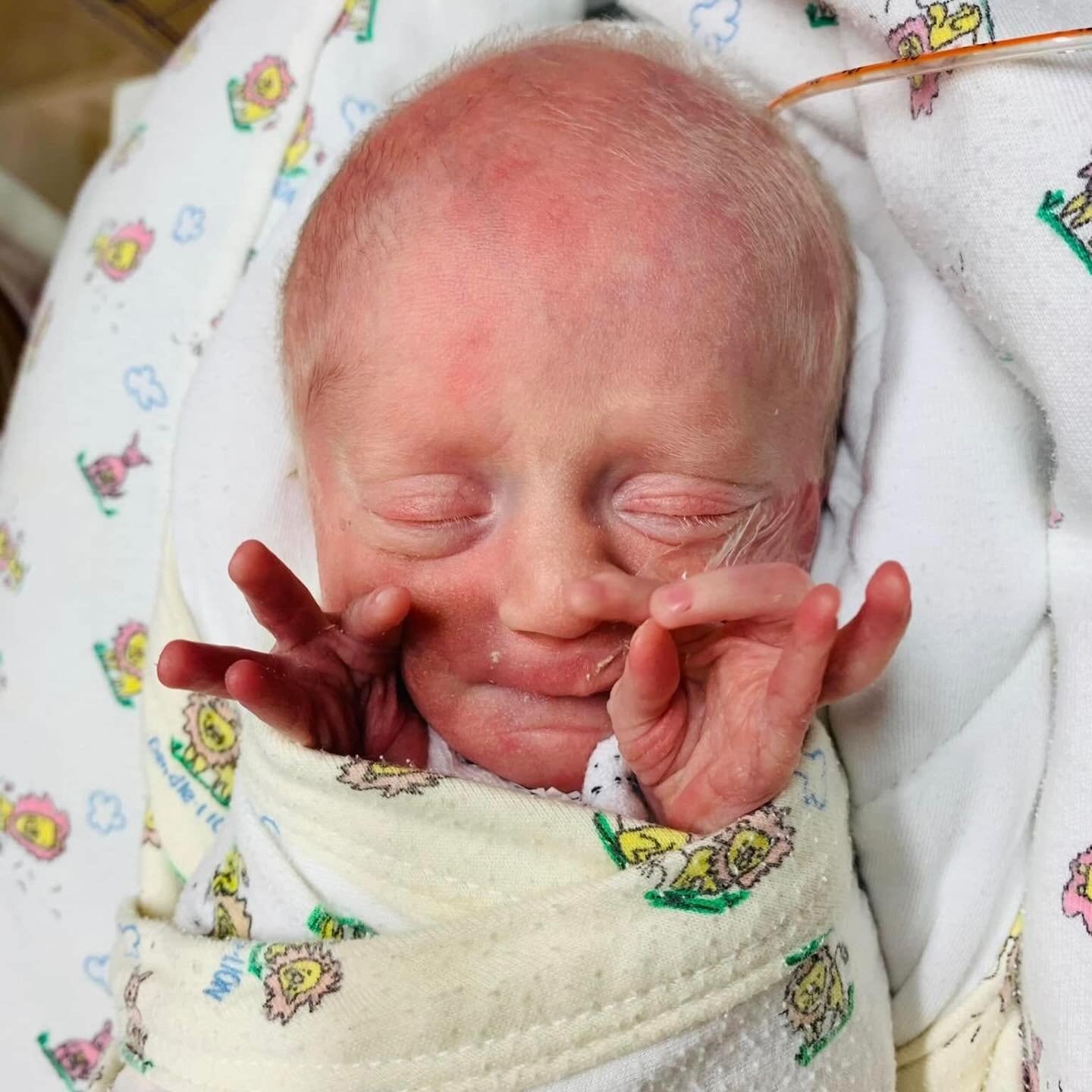 Blog Update: The Day Everything Changed

It was the height of COVID, and we were completely alone, trying to process a future filled with more questions than answers

We learned about Molly&rsquo;s rare genetic condition on Halloween &mdash; our favo