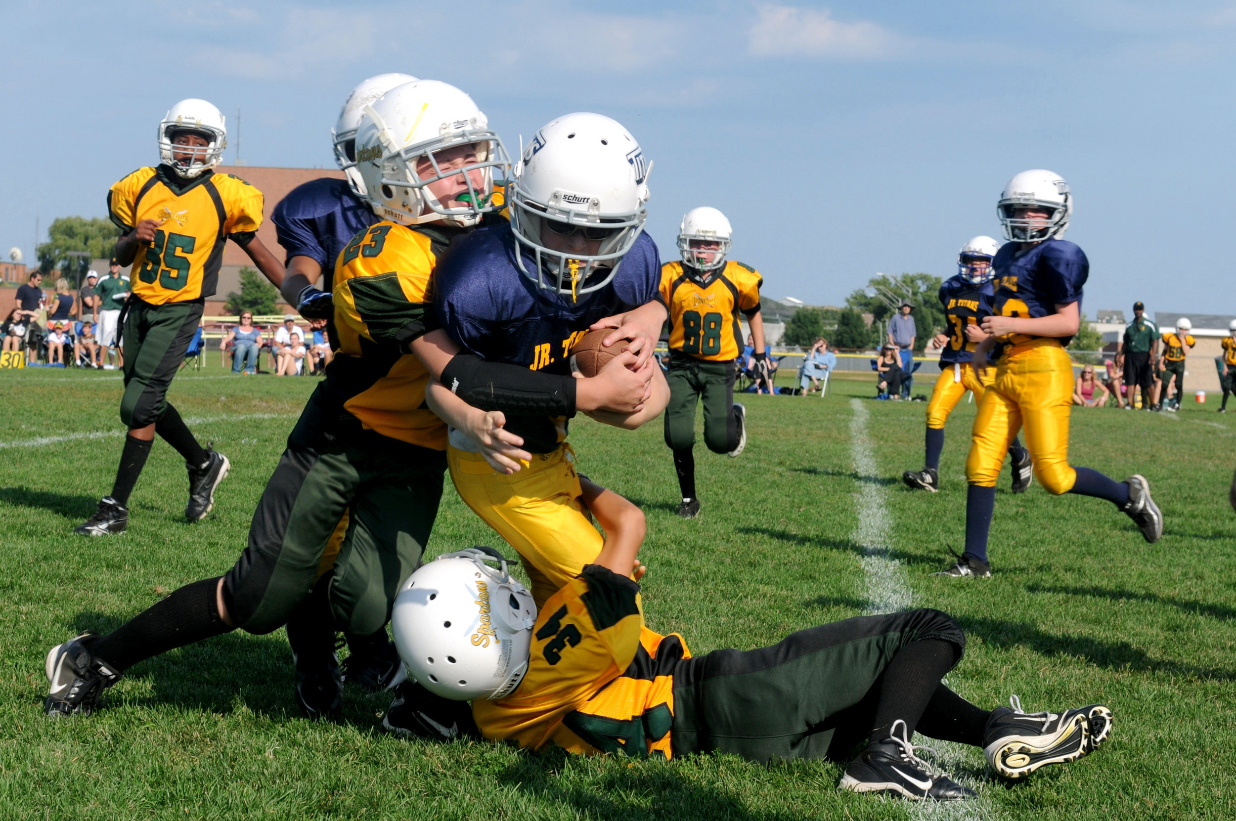 Sports Concussions - Part 1