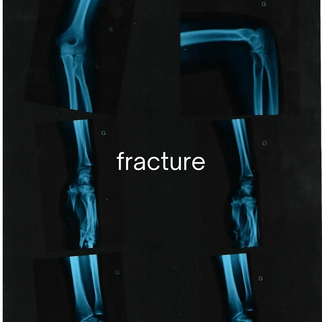 Fracture