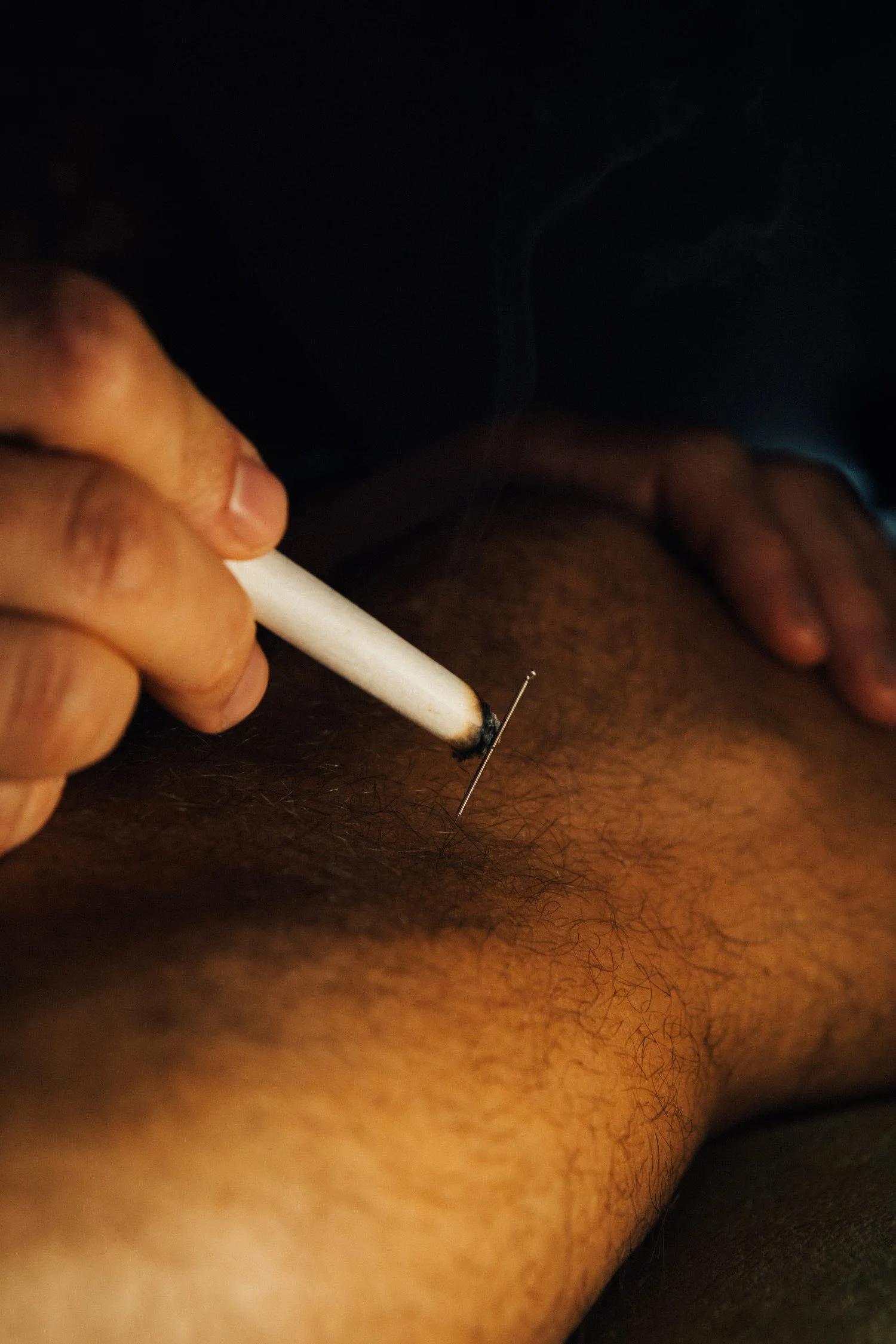 Diego performing moxibustion using moxa to his patient in his acupuncture clinic in Hillcrest San Diego which offers free moxibustion for tension pain and blood flow improvements