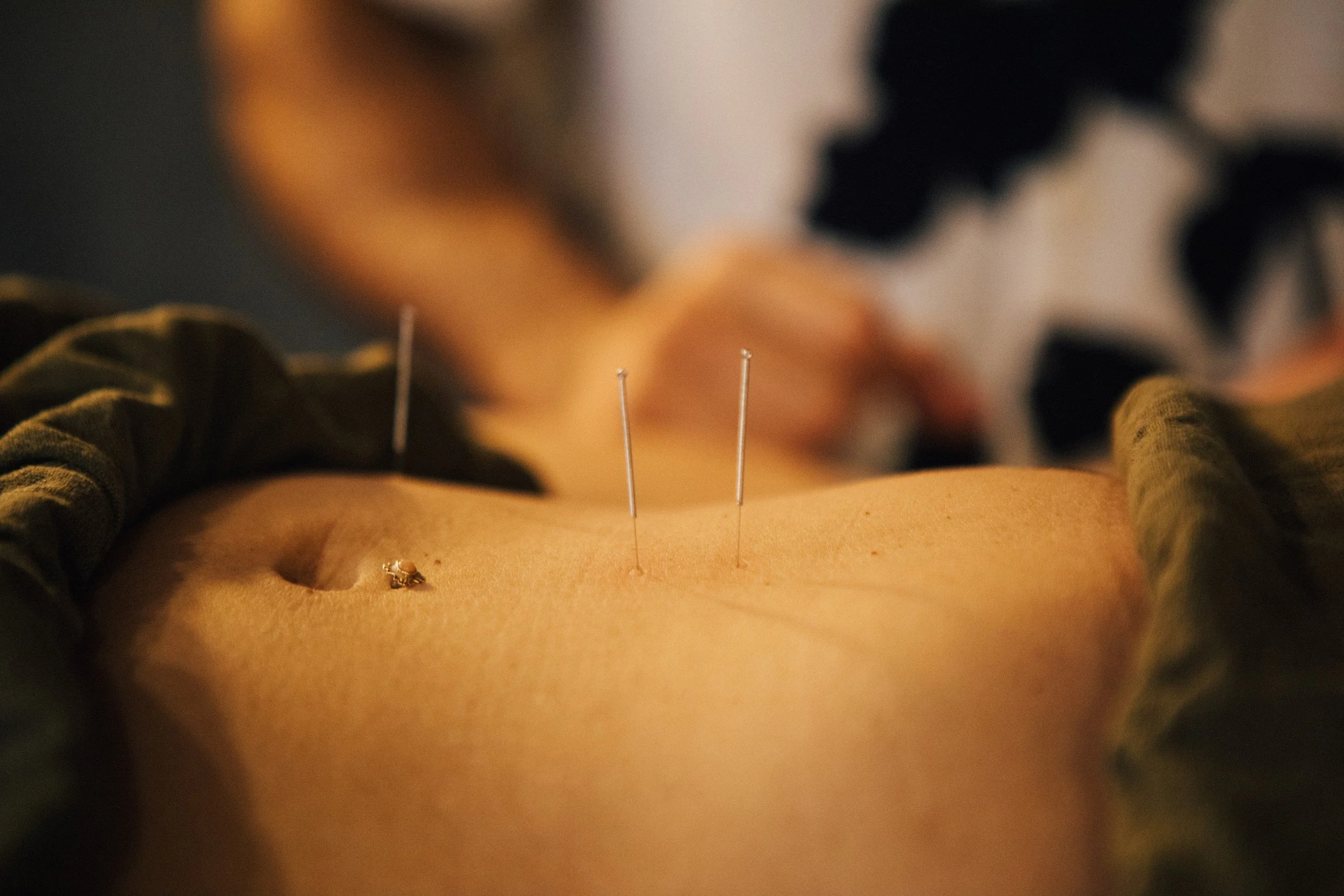 Classical Chinese Medicine treating fertility condition in San Diego