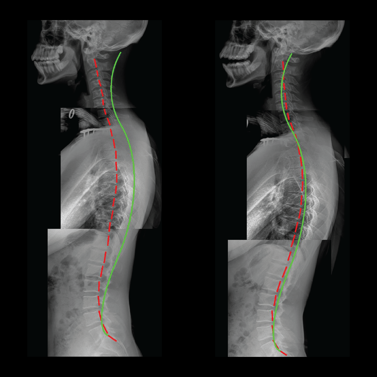 The Power of Posture