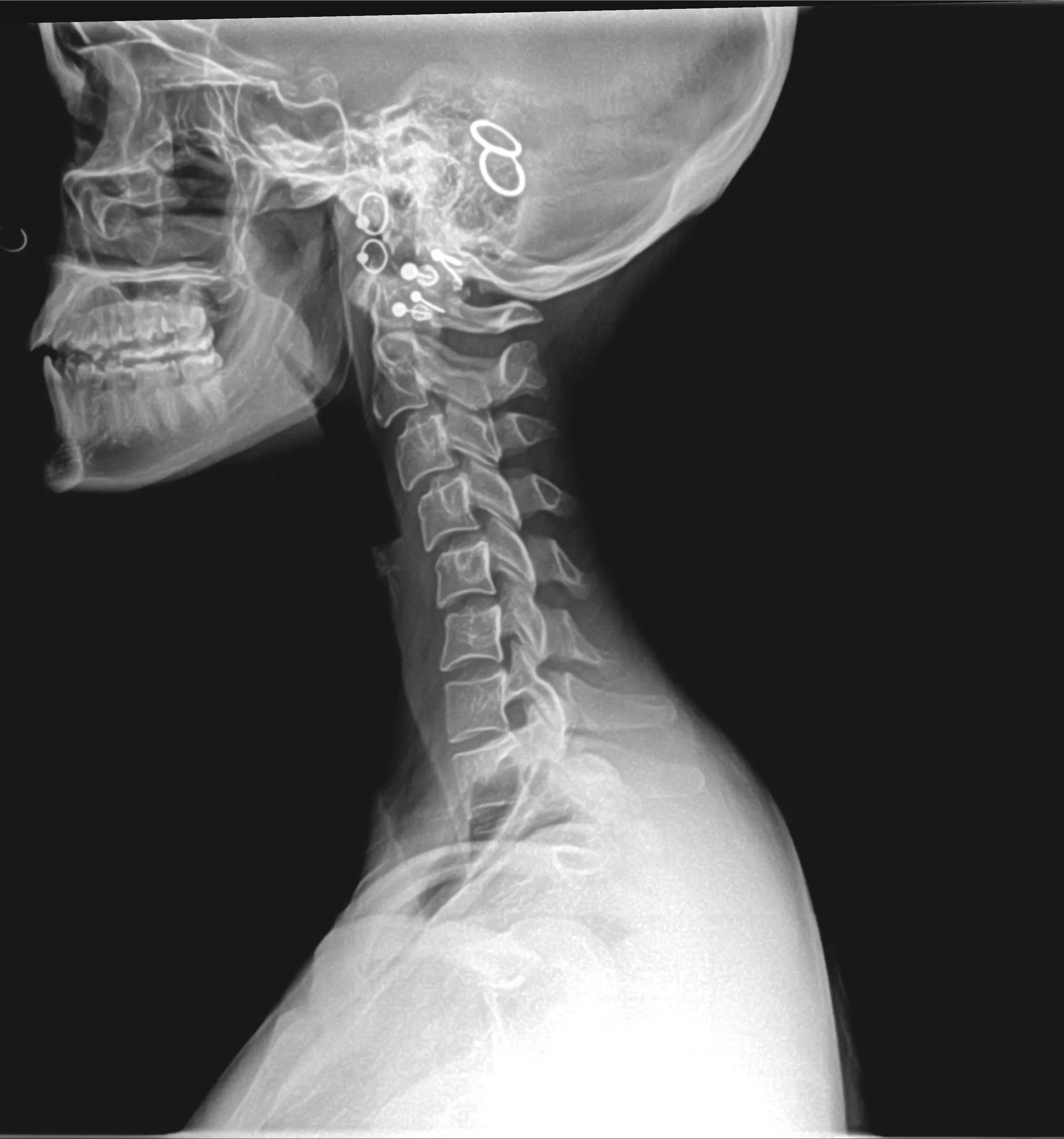 stock image of patients X-Ray