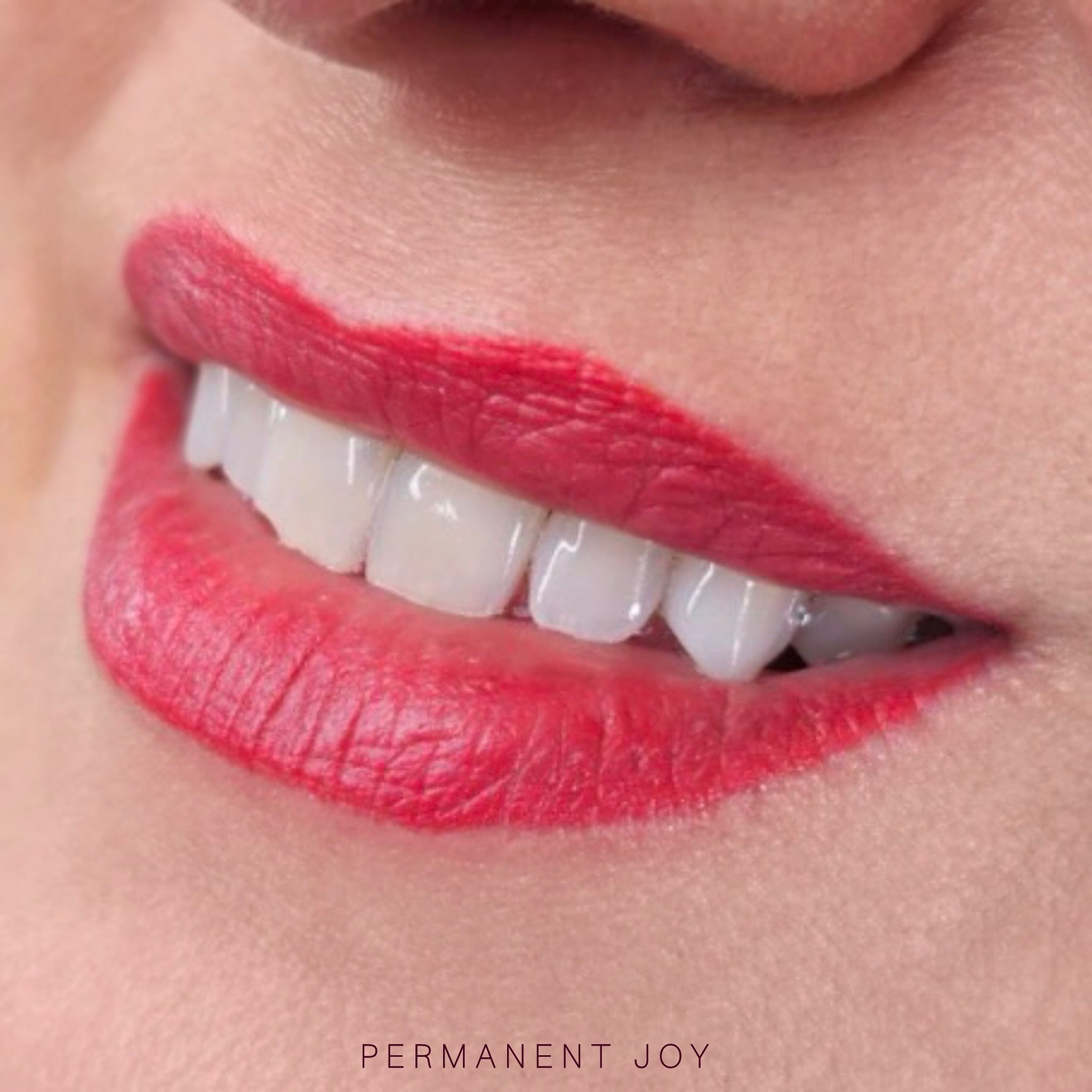 💗 True Natural Lip Blush Revealed! HEALED WORK 💗

Take a look at these smiling lips, now flaunting the ultimate natural lipstick look that will grace her life for the next four years! This lovely shade not only enhances but will loyally serve her, 