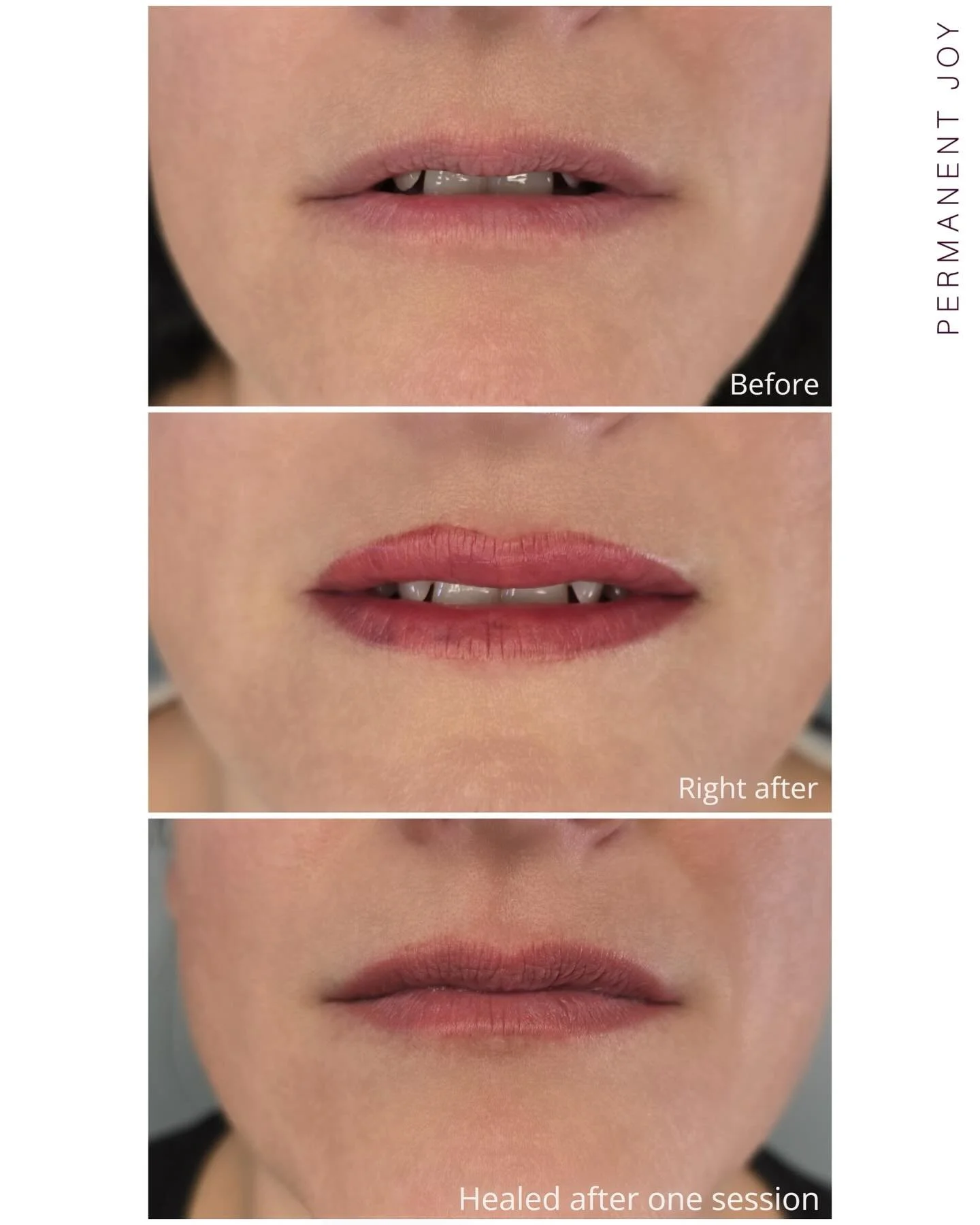 Before✨ Right After ✨ Healed After One Session 💋

This client came in wanting just a little more color and a slightly more defined lip shape while keeping everything very natural. The goal was not to change her lips, but to enhance what she already 