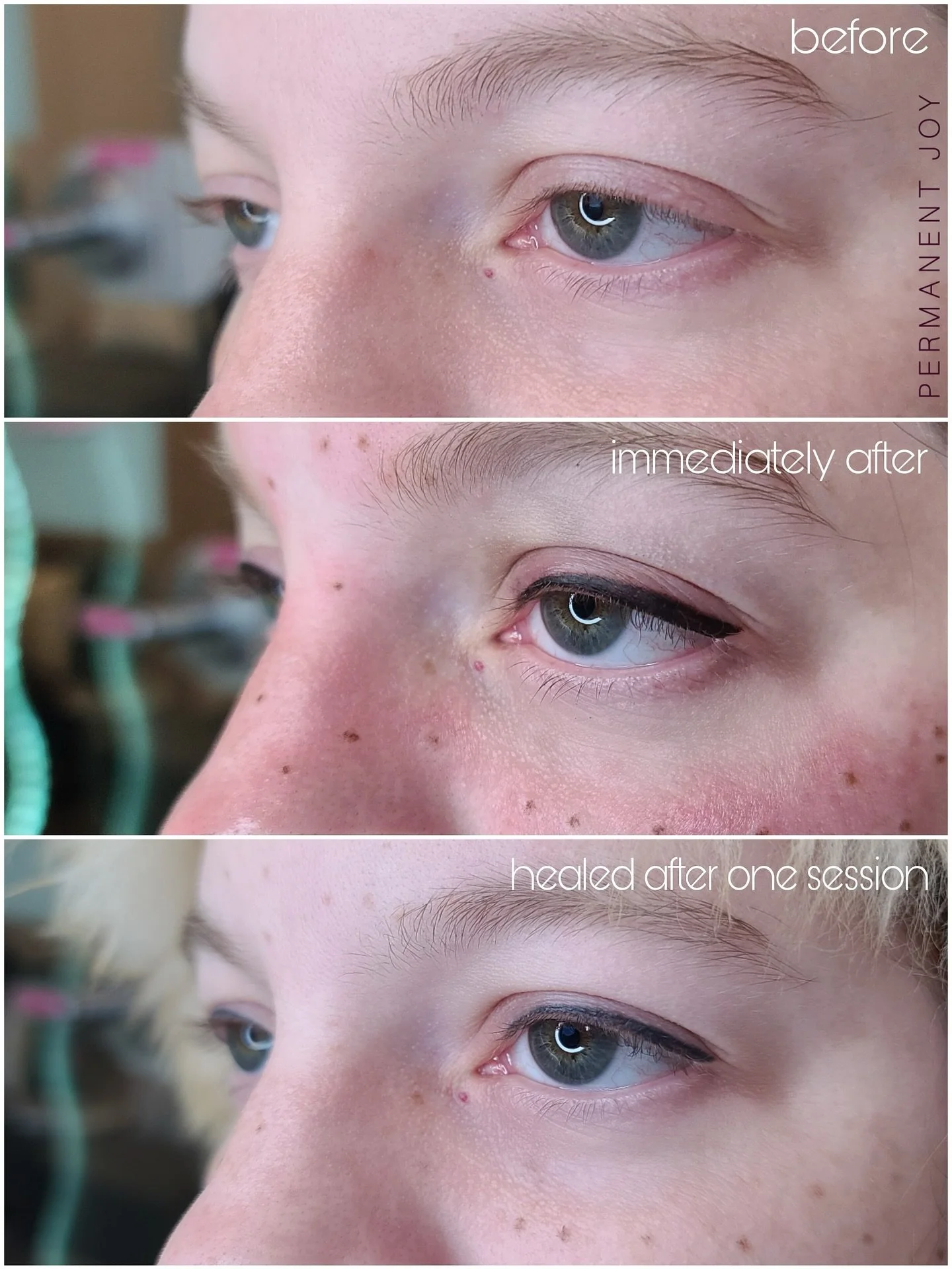 Eyeliner + Freckles ✨ Before ✨ Immediately After ✨ Healed After One Session

Freckles are one of the most asked about services, and this is a great example of how natural they can look when done правильно ✨

On fair skin, it is very easy to go too da
