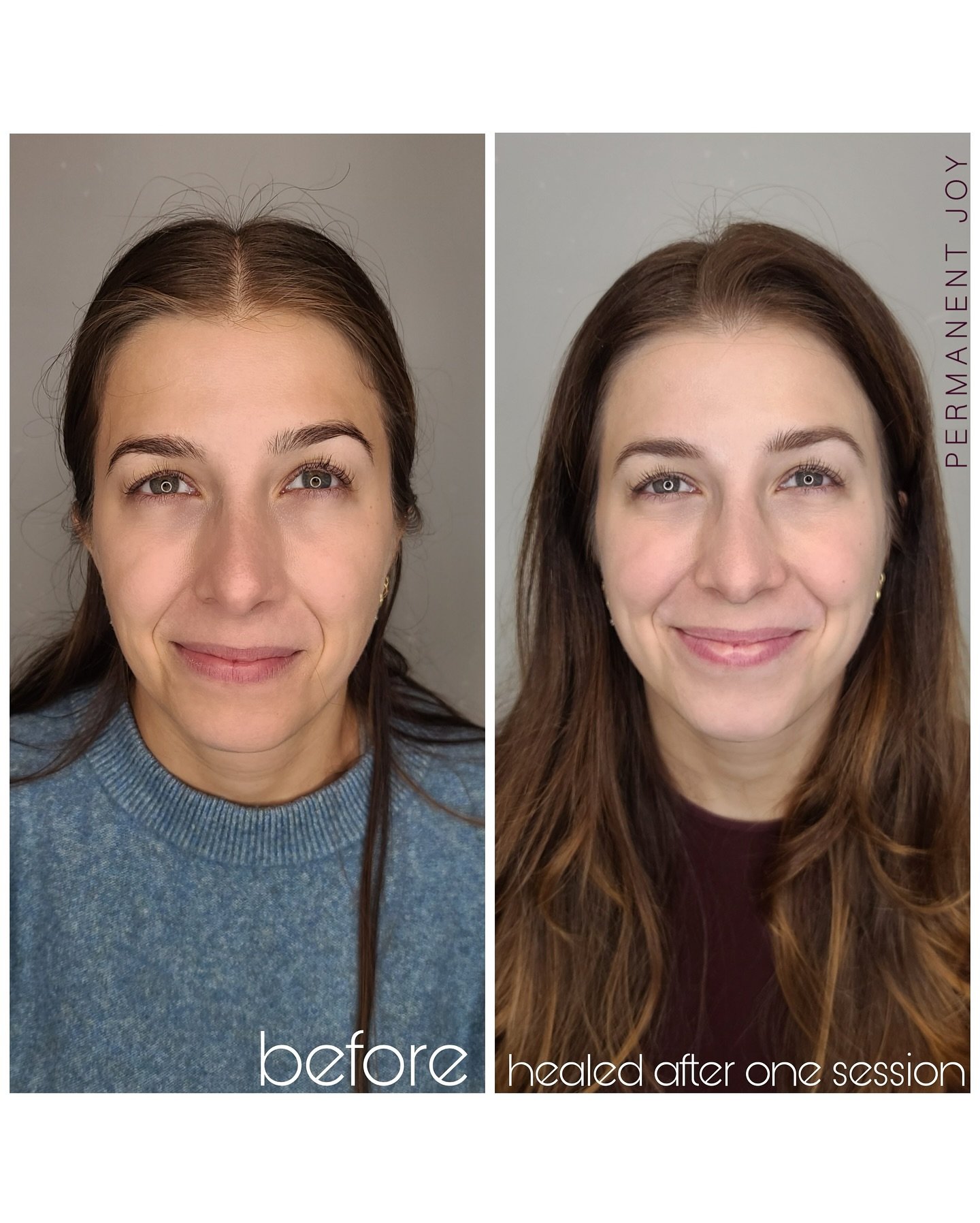 Powder Brows ✨ Before ✨ Healed After one session

She already had naturally beautiful brows and just wanted a bit more fullness and definition. That&rsquo;s exactly what we did, enhancing what was already there without overdoing it.

The brows still 