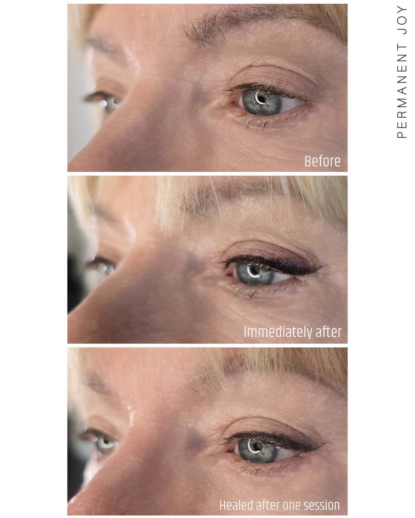 Shaded Liner ✨

This is one of the most requested eyeliner styles I get. A lot of people come in specifically asking for this soft, diffused look.

But here is the important part, we always map everything out before the procedure. We draw it on, we l