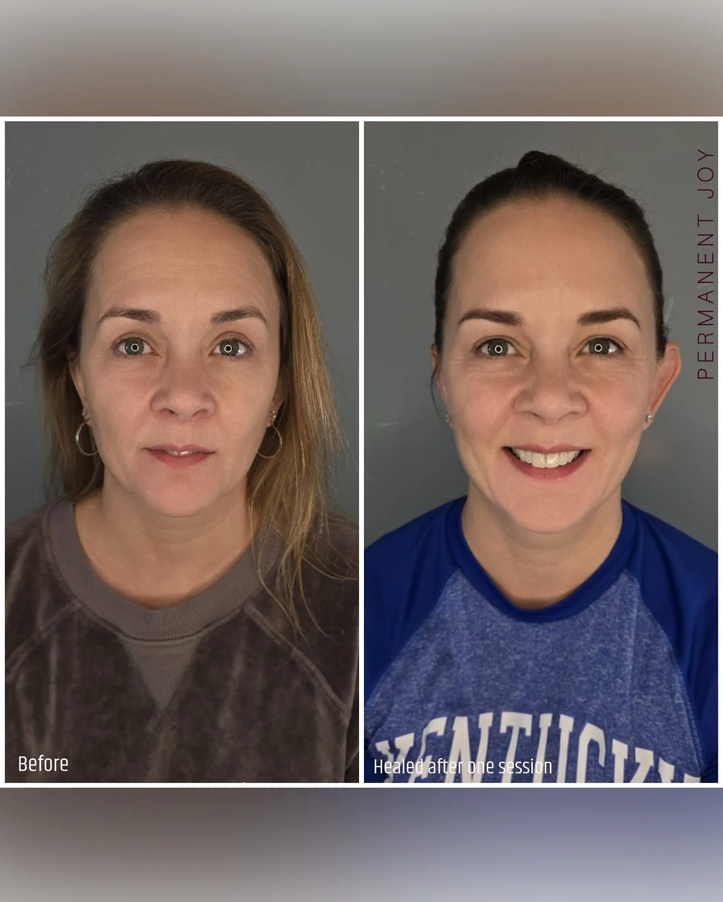 Brows ✨ Before ✨ Healed After One Session

These brows were already naturally beautiful, full, and well shaped. The goal here was not to change them, but to gently deepen the color and enhance what was already there.

With this kind of request, I alw