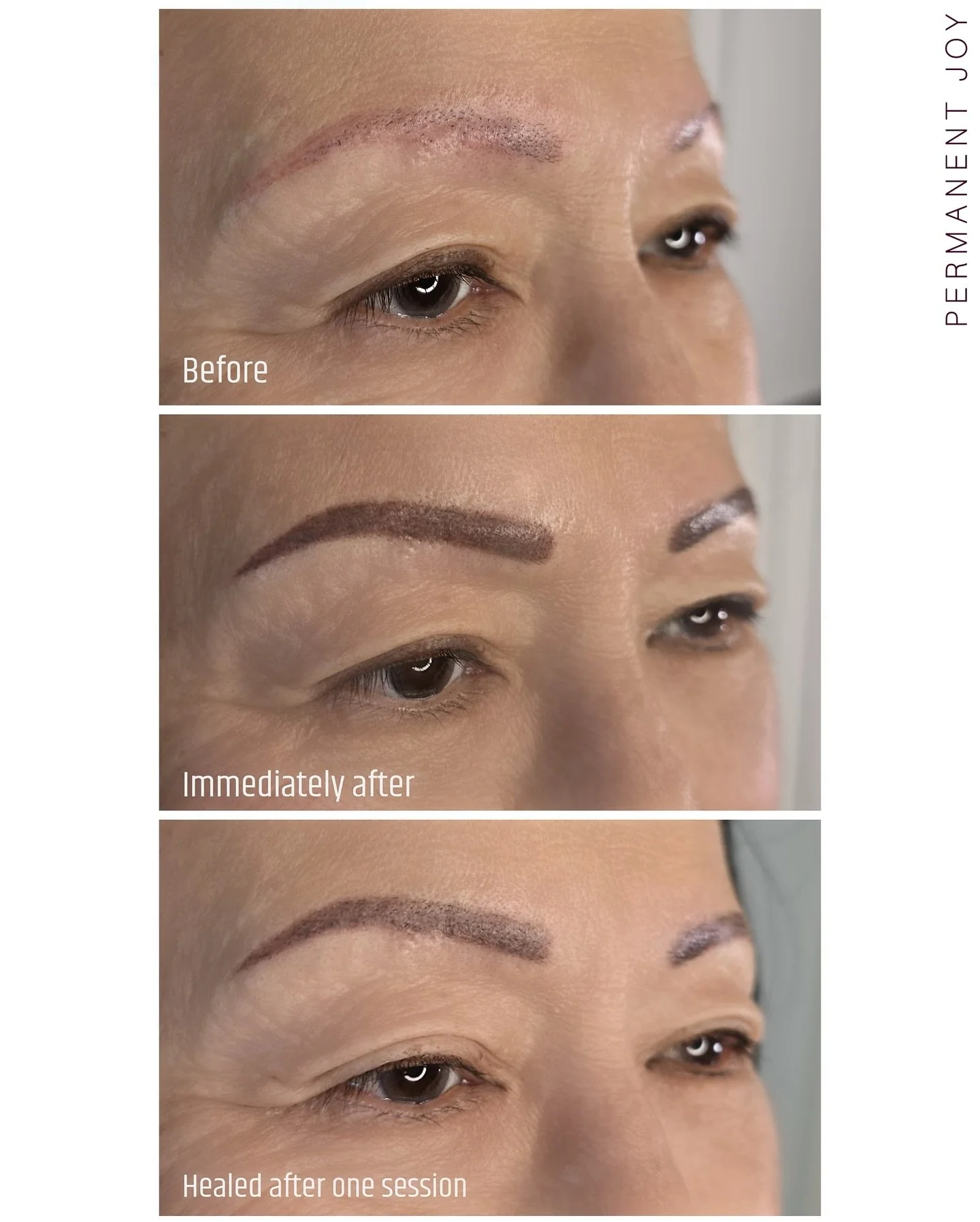 Brow Cover Up ✨ 

This was a more complex case of previous permanent makeup. By the books, situations like this are often referred for laser removal first.

However, every case is individual. This client loves a bolder brow look, and her everyday mak