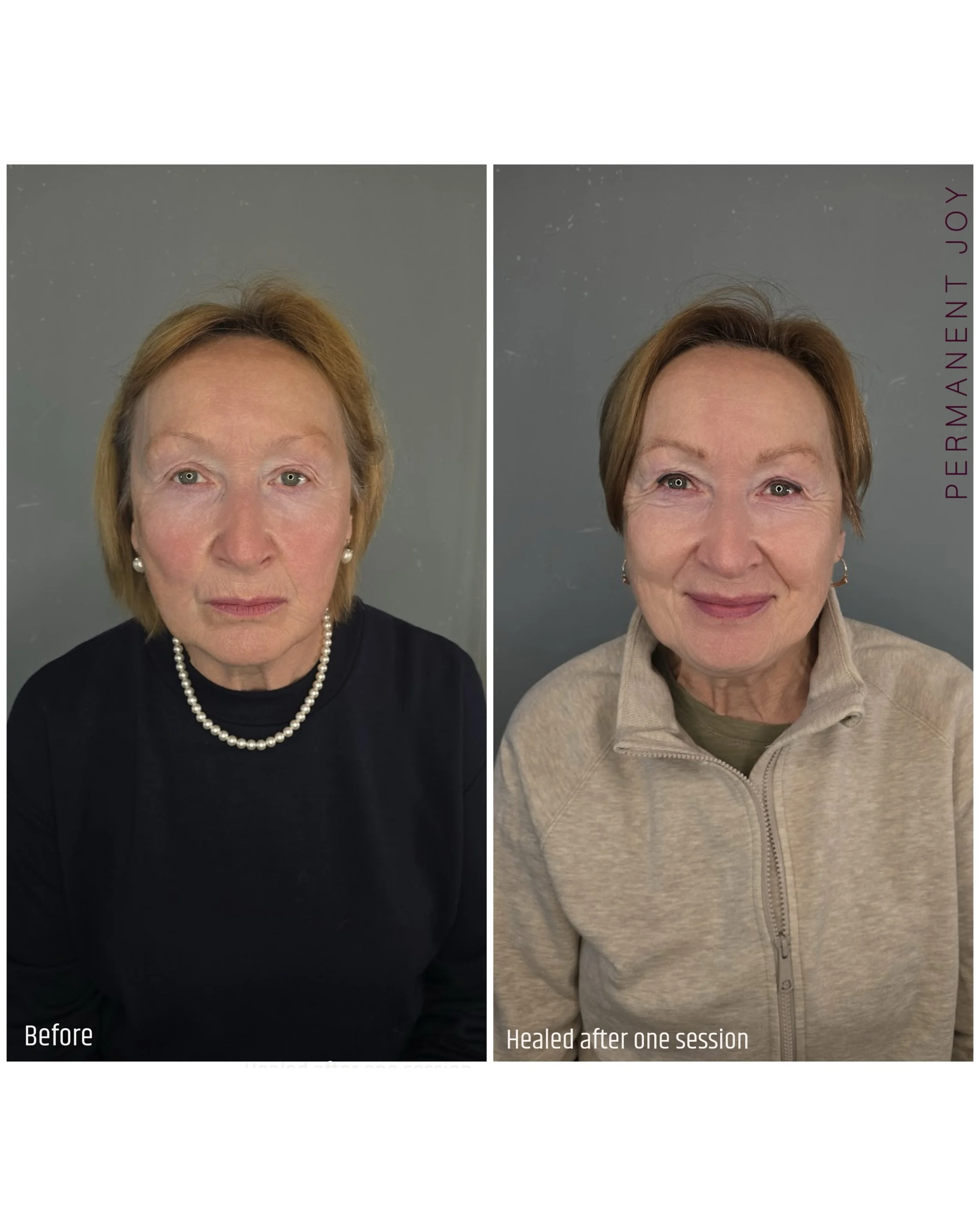 Beautiful healed brows ✨ Before &amp; Healed After One Session 

This client came in wanting a soft, natural result, and that is exactly what we created 💕

The brows healed beautifully with a clean, effortless look that enhances her features without
