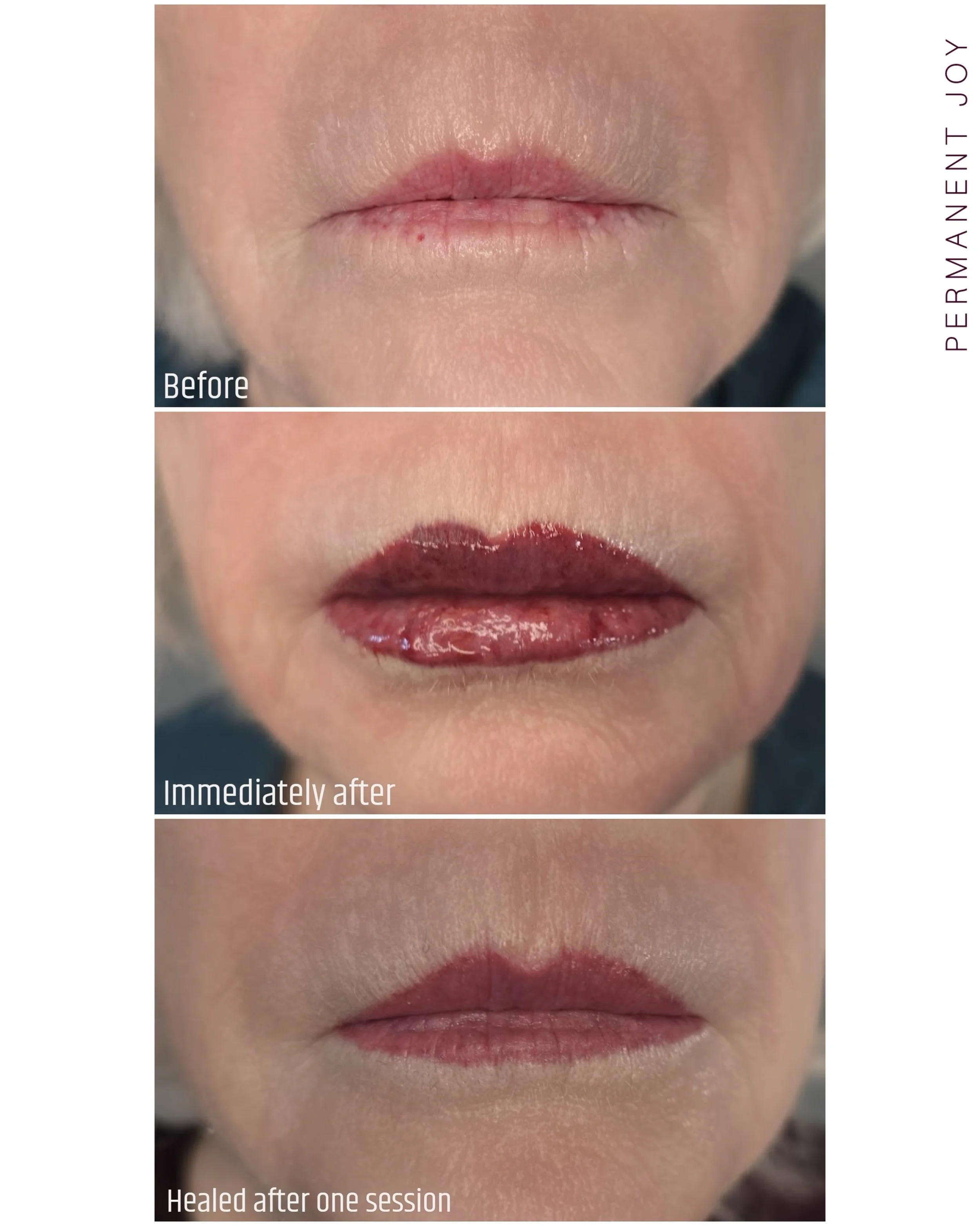 Lip Blushing ✨ Before ✨ Right After ✨ Healed

This is a great example of how dramatic the healing process can sometimes look right after the procedure, especially on very pale and sensitive lips.

You can clearly see that the skin had a hard time 💕 