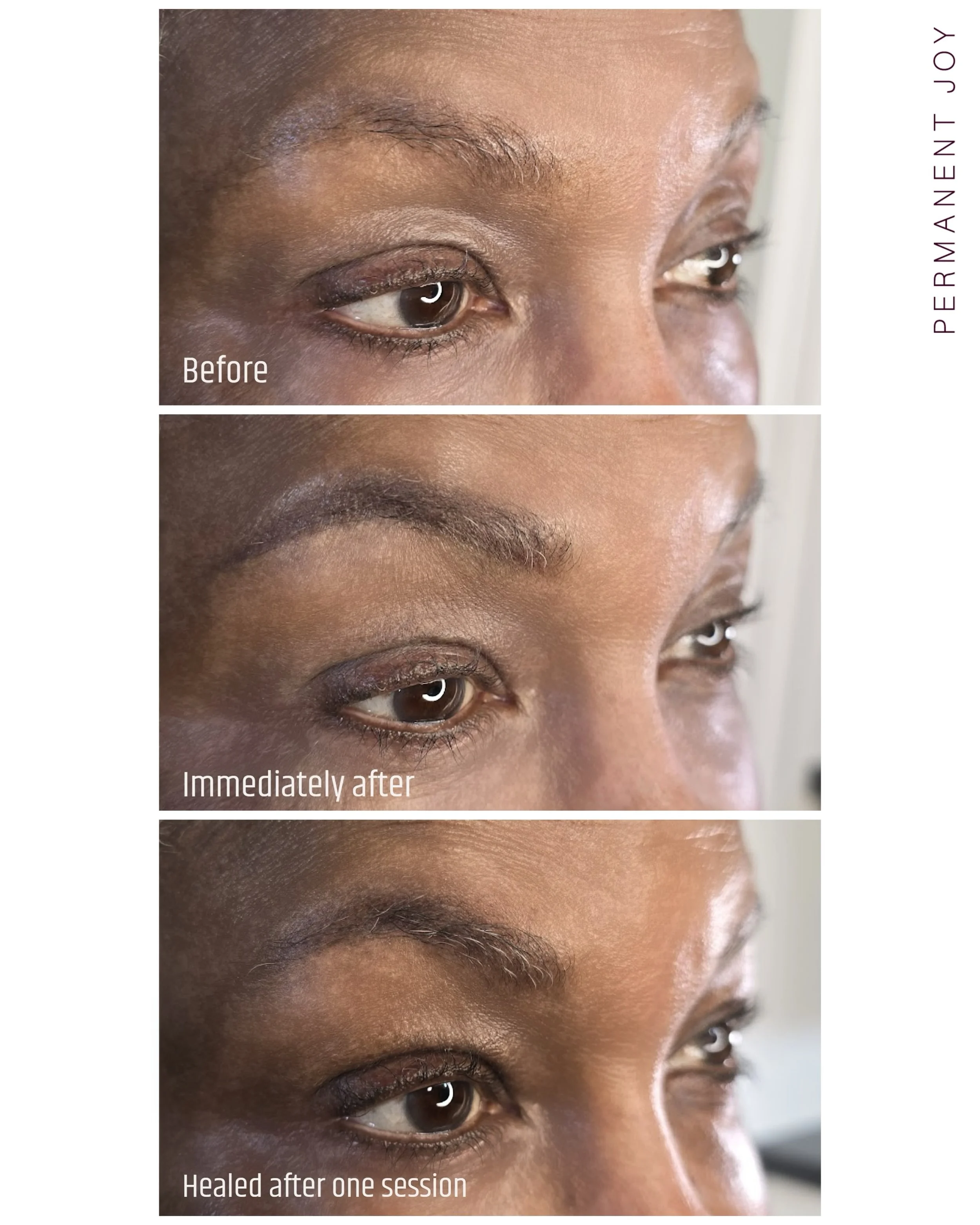 ✨ Soft natural brows for melanin-rich skin ✨

My client came to me wanting brows that looked extremely natural 🤍

As a woman of color, she told me it had always been difficult to find a brow pencil that looked soft and natural on her skin tone while