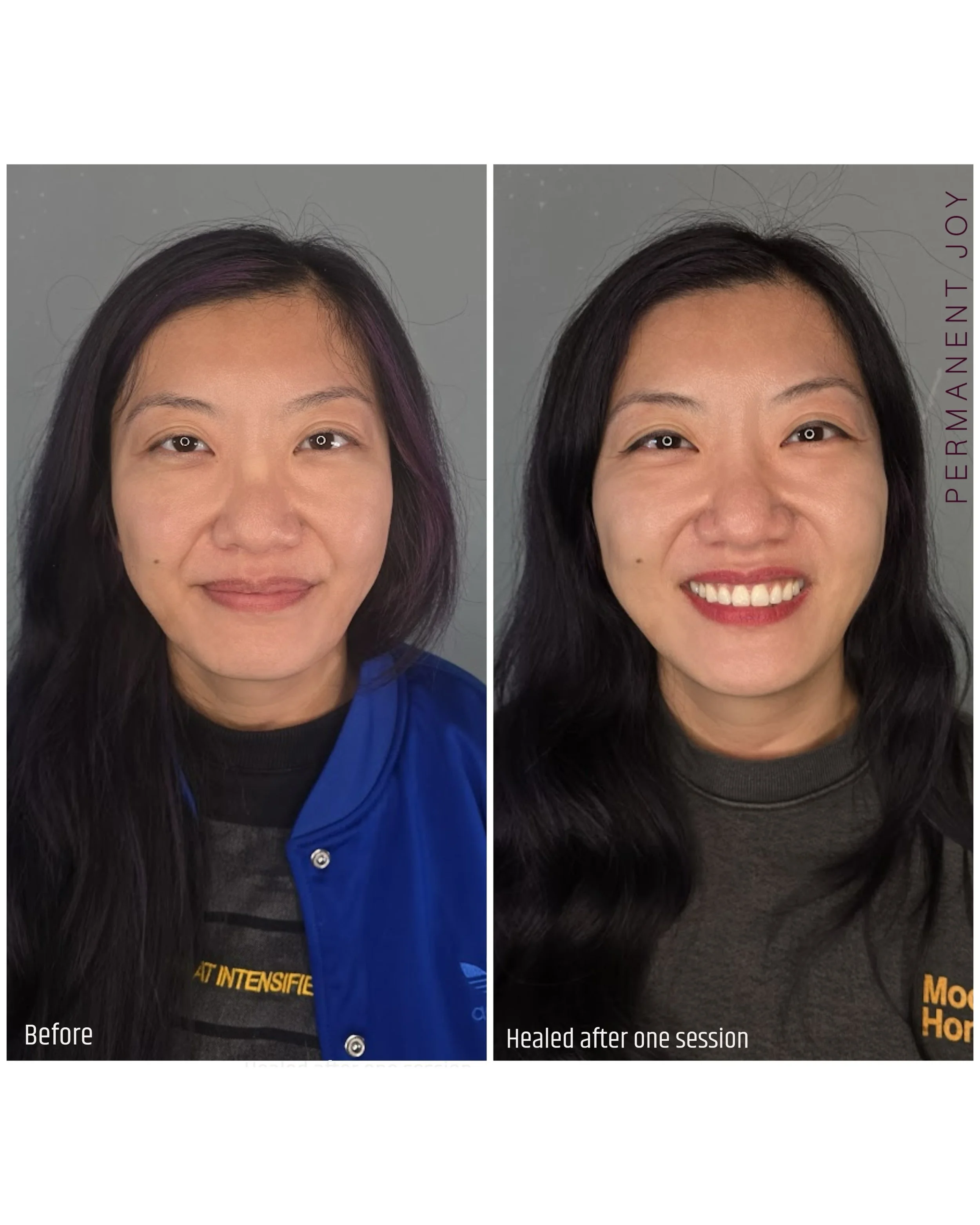 ✨ Lip Neutralization Before &amp; Healed After One Session ✨

My client came in wanting to even out the color of her lips 💋

The outer part of her lips was naturally darker than the inner area, and she also wanted to bring back a healthier, more liv