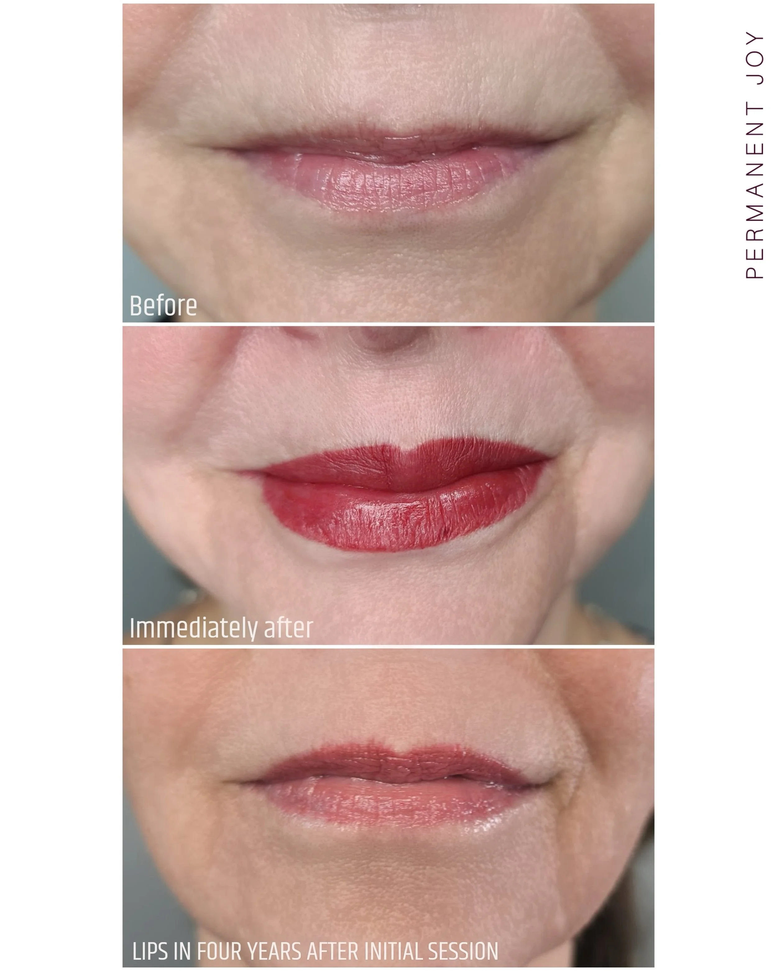 ✨ LIPS FOUR YEARS AFTER THE INITIAL SESSION ✨

My client originally came in wanting to bring more light, color, and definition to her lips while also enhancing the overall shape 💋

And four years later, the healed color and shape still look so beaut