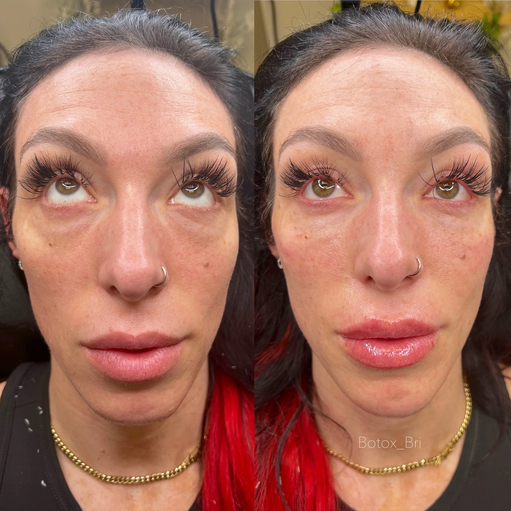 under eyes.jpeg