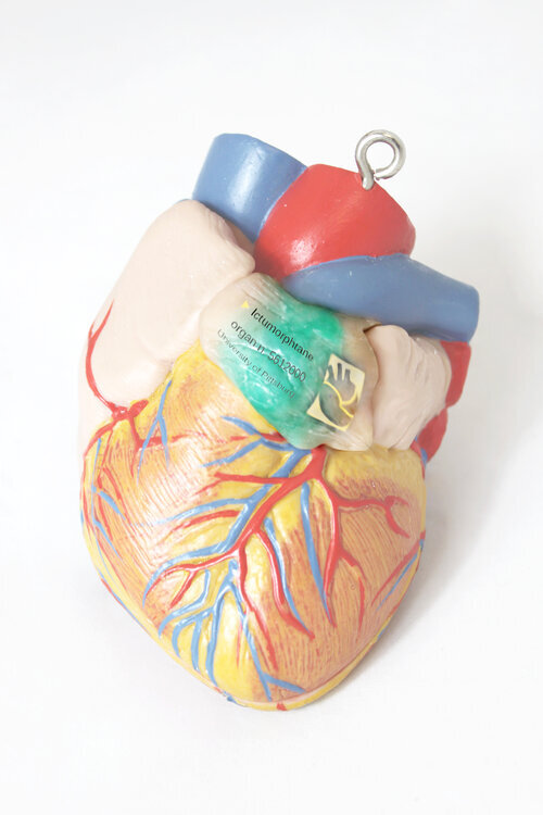 The Self-Donor Workshop