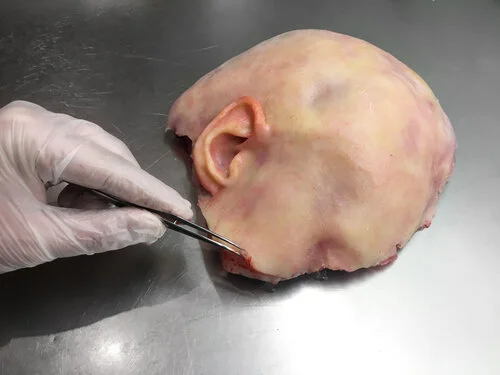 The Anatomy Lesson: Dissecting Medical Futures