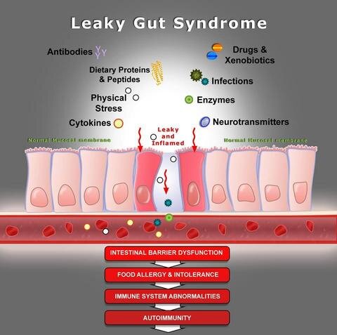 How to Fix Leaky Gut — Wellness Speaks