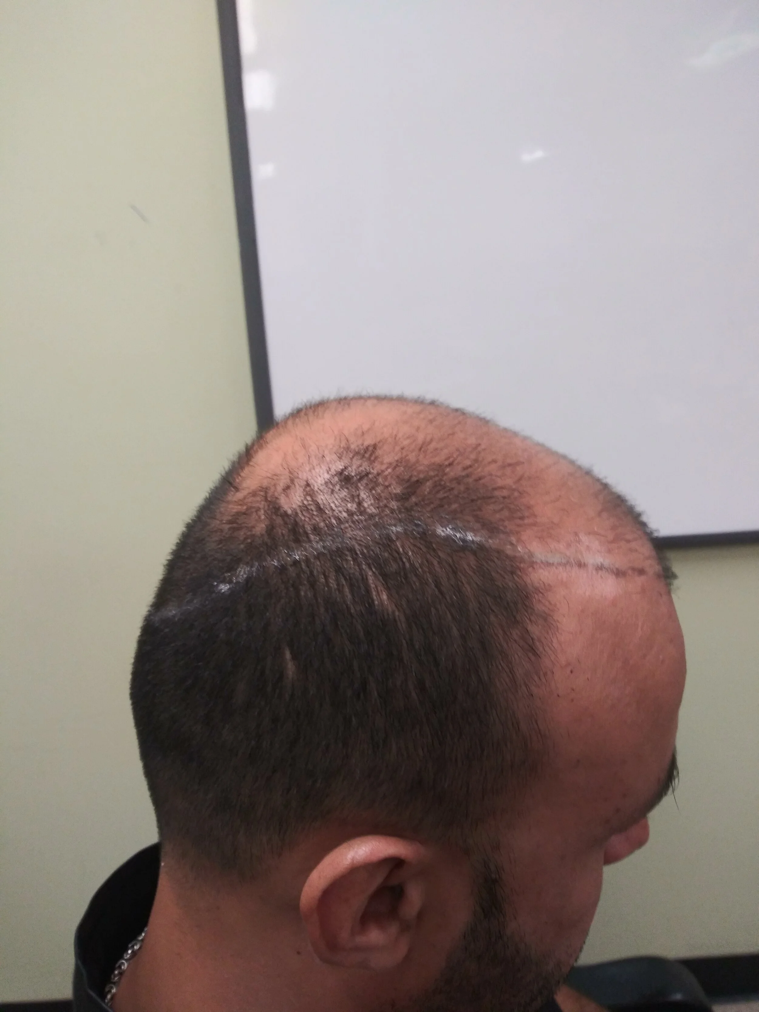 Markings - Placement Illustration.jpg