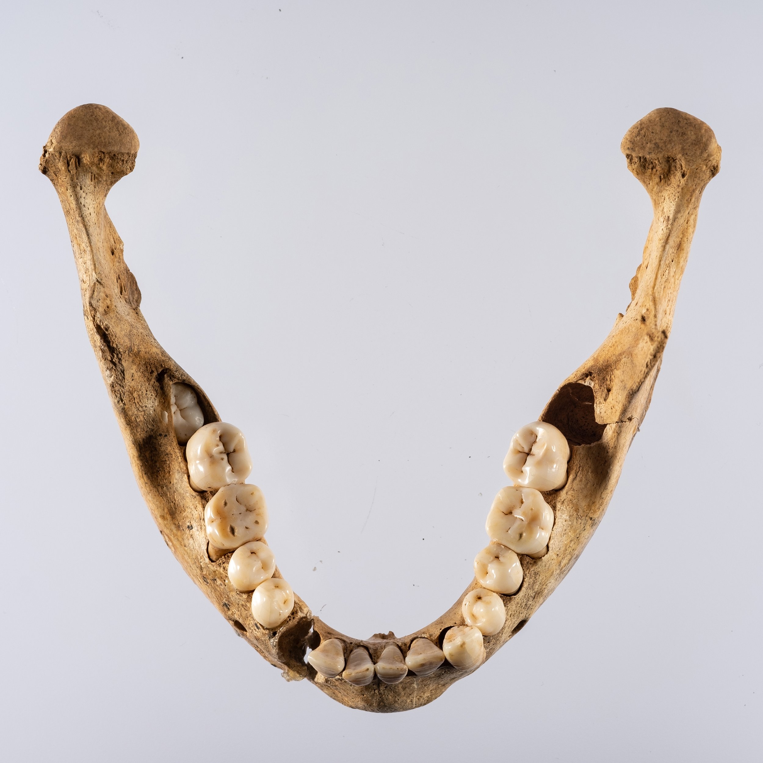 Human Jaw