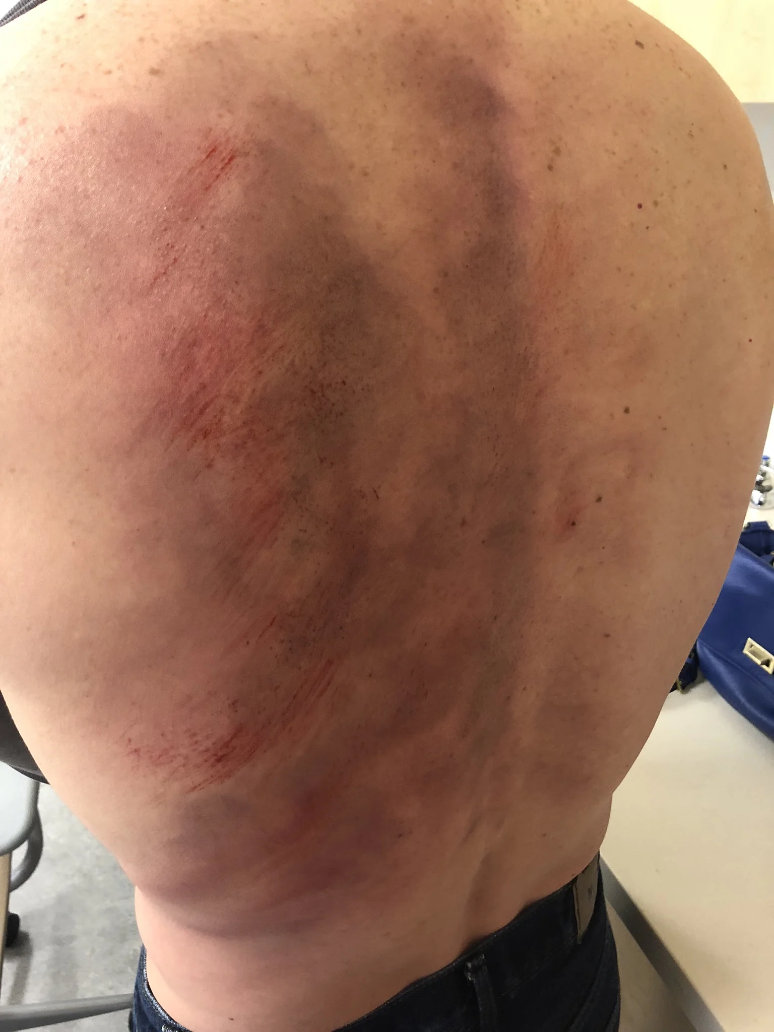 Crush victim OHSU SIM lab