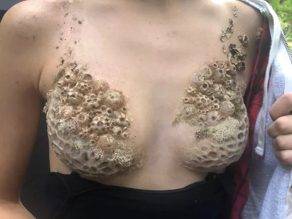 Waterproof Prosthetic