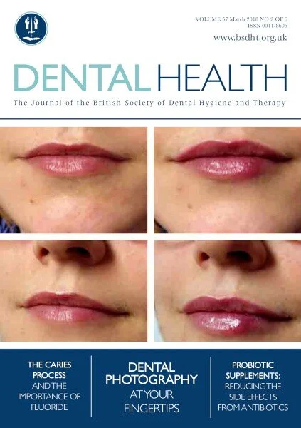 Top Tips for Impression Taking Dental Health BSDHT