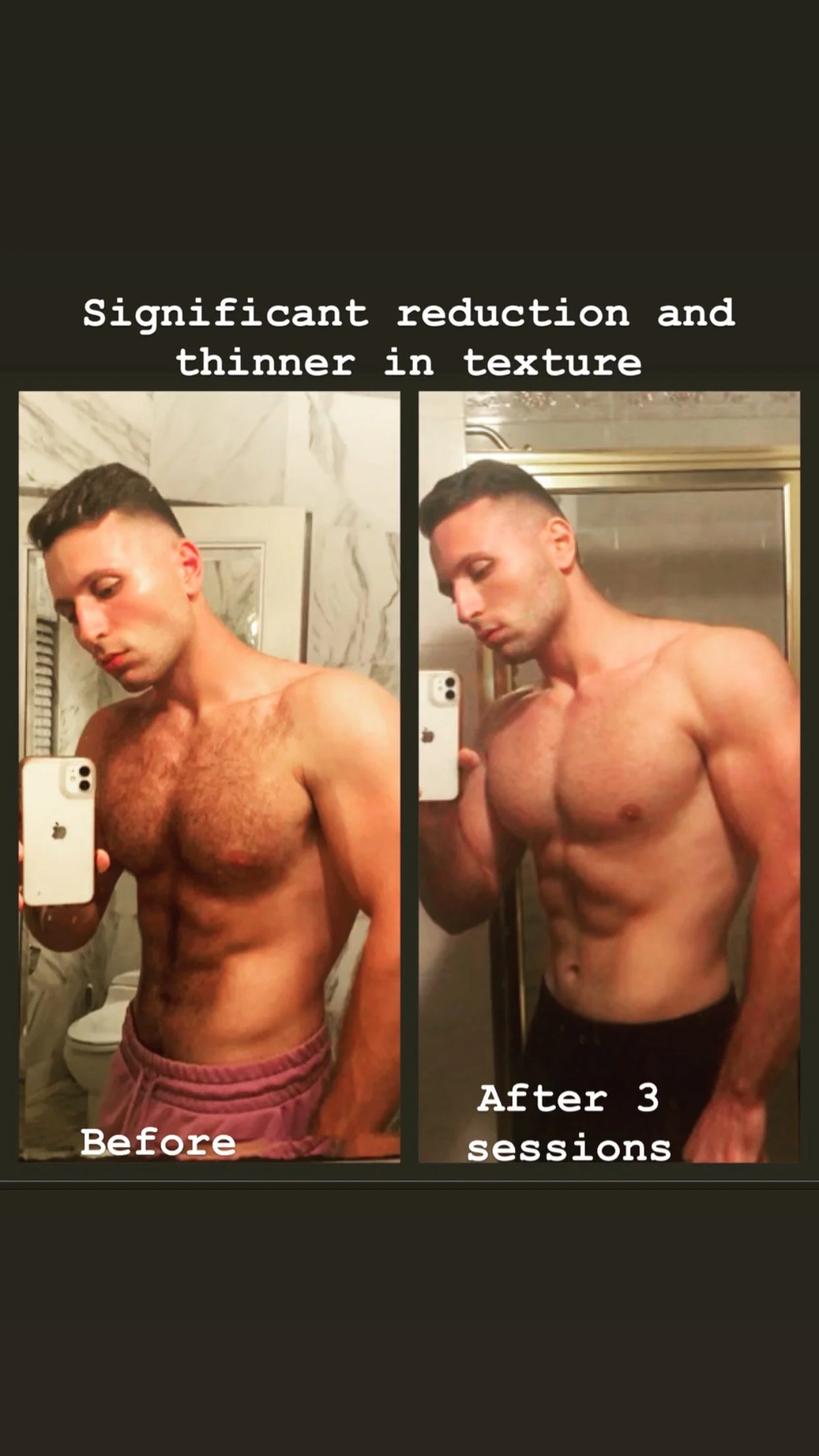 Comparison of a shirtless man in a bathroom mirror before and after sessions, showing body transformation. Text reads 'Significant reduction and thinner in texture' highlighting the changes.