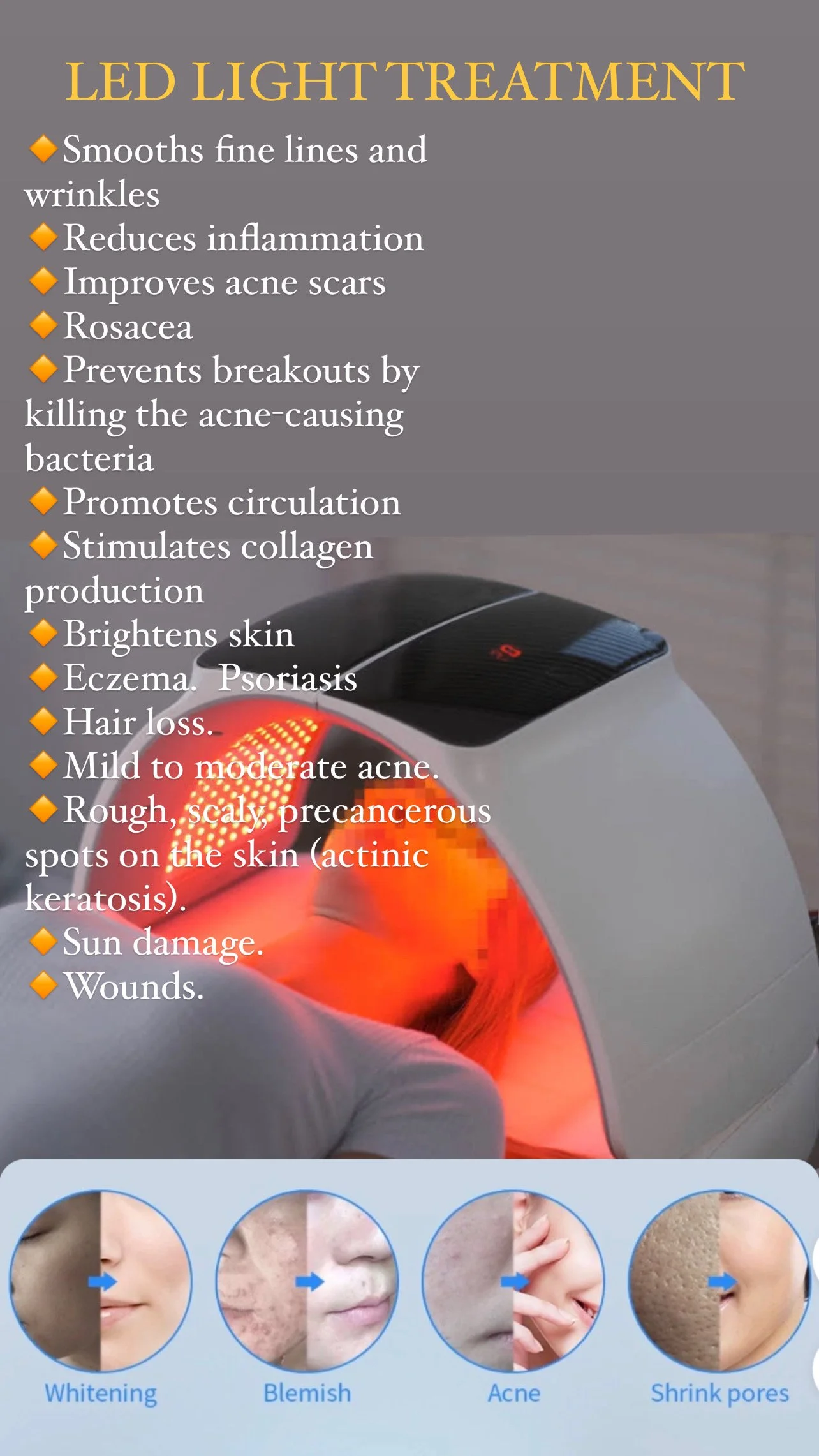 Infographic about LED light treatment benefits, including smoothing wrinkles, reducing inflammation, improving acne scars, treating rosacea, promoting circulation, and brightening skin. Also shows a person under a red light device and before-and-afte