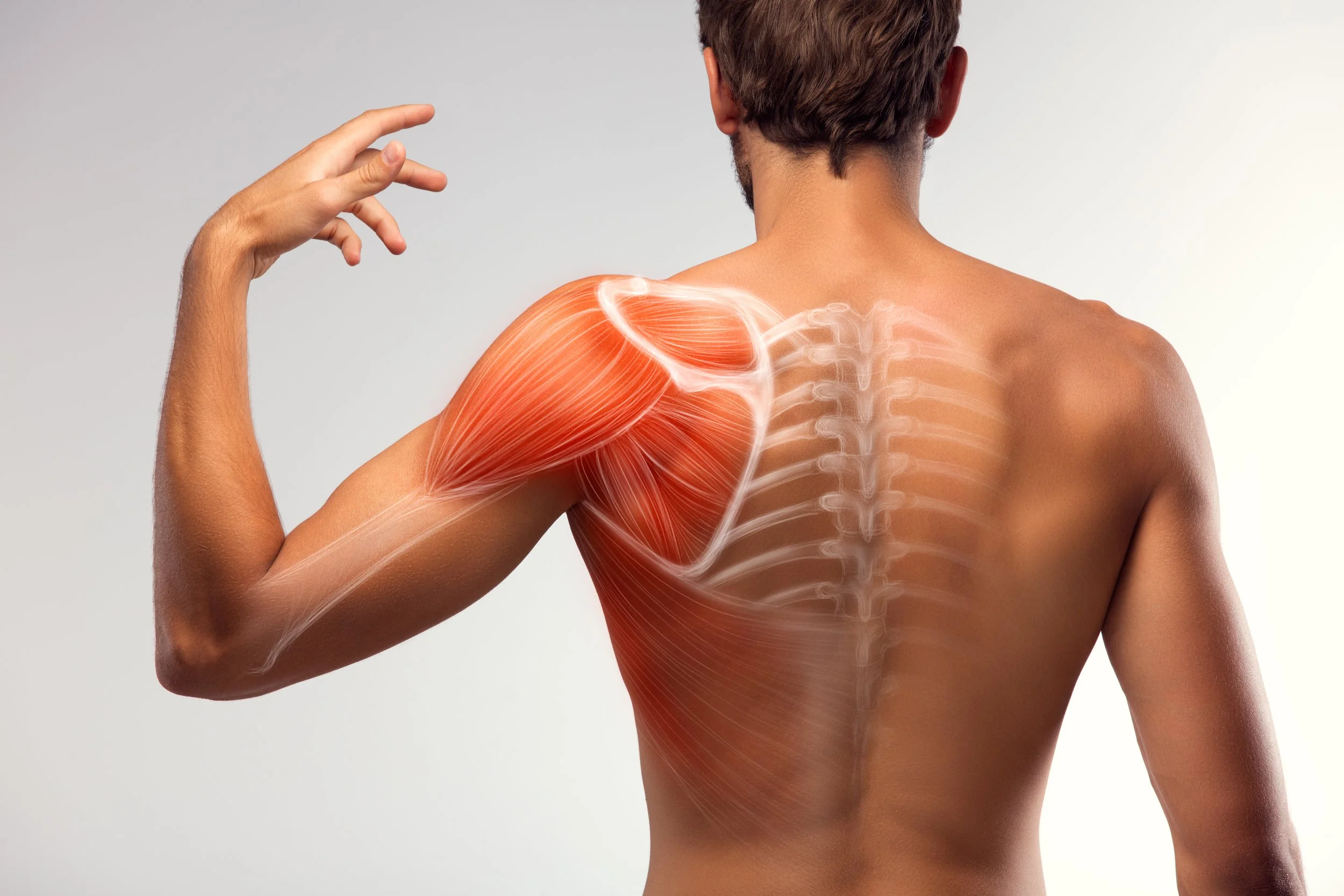 Rotator cuff injuries (shoulder)