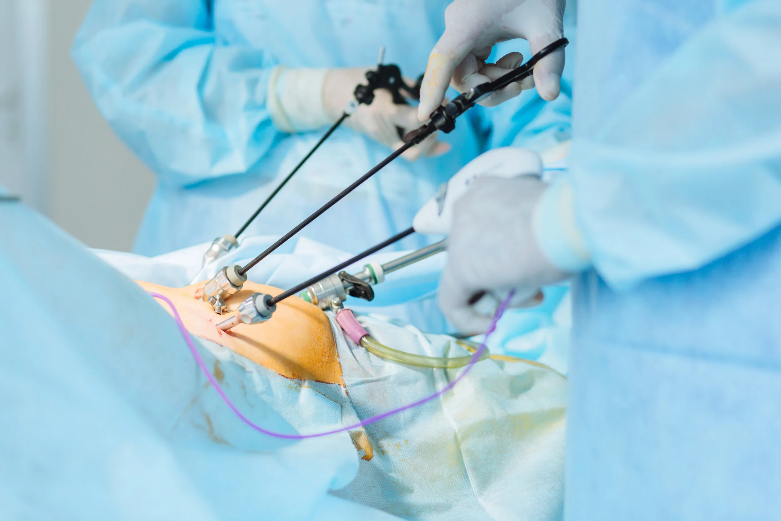 Perth Colorectal Surgery — Ventral Rectopexy