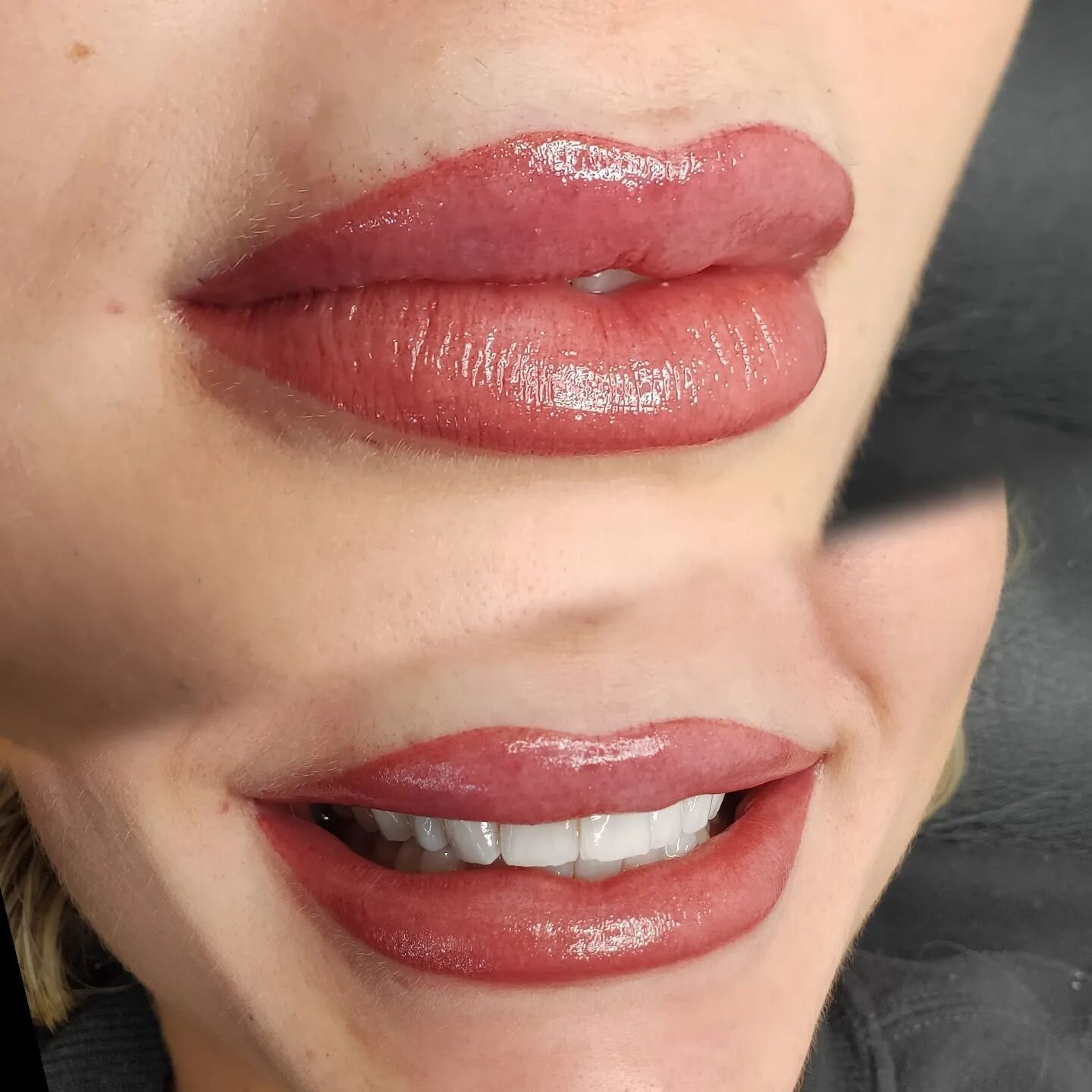 When you've had filler but you'd like your lip border more defined. 🩷🩵🩷
Are your lips ready for Christmas? 🎄 🎁 Book now link in bio.